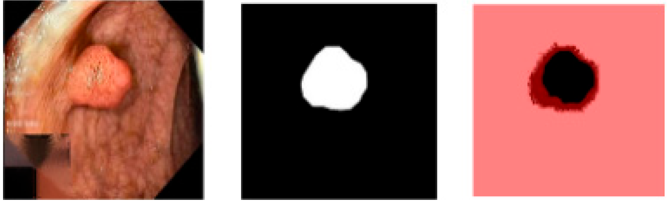 Gastroent 13 00027 g007