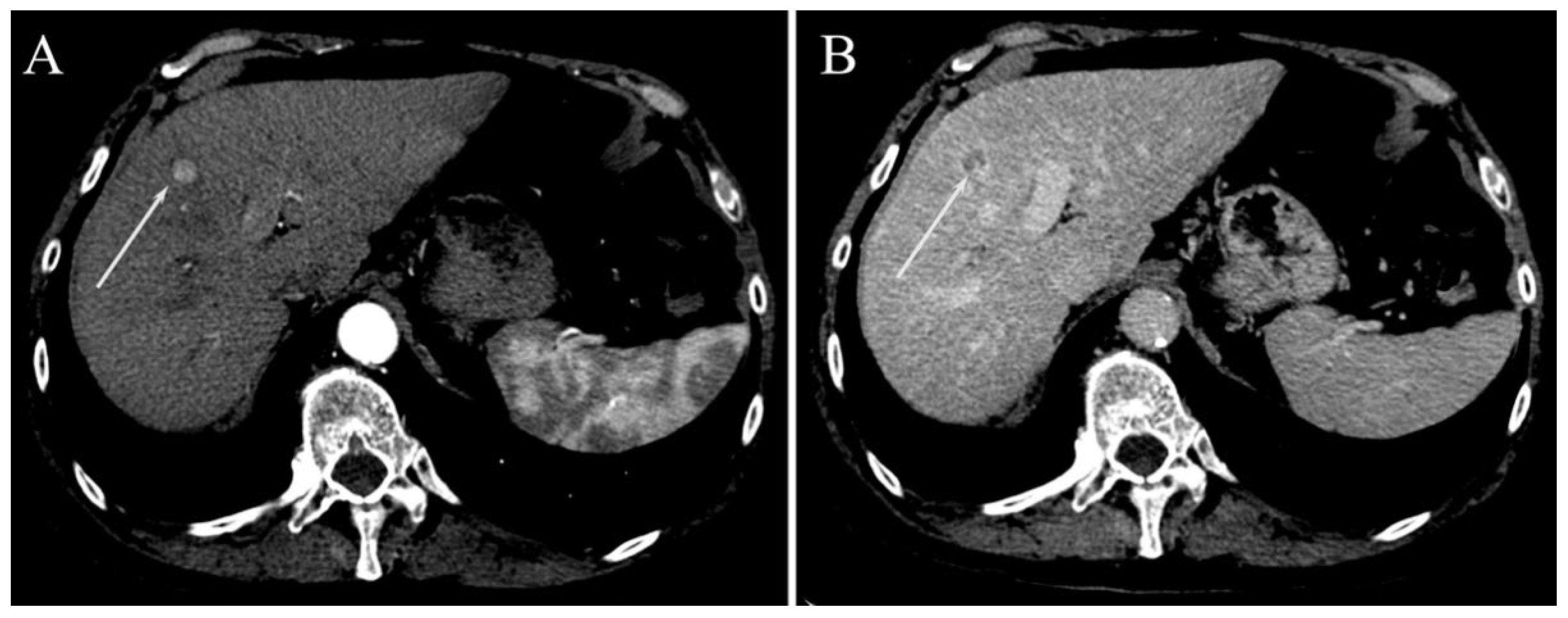 Gastroent 13 00028 g003