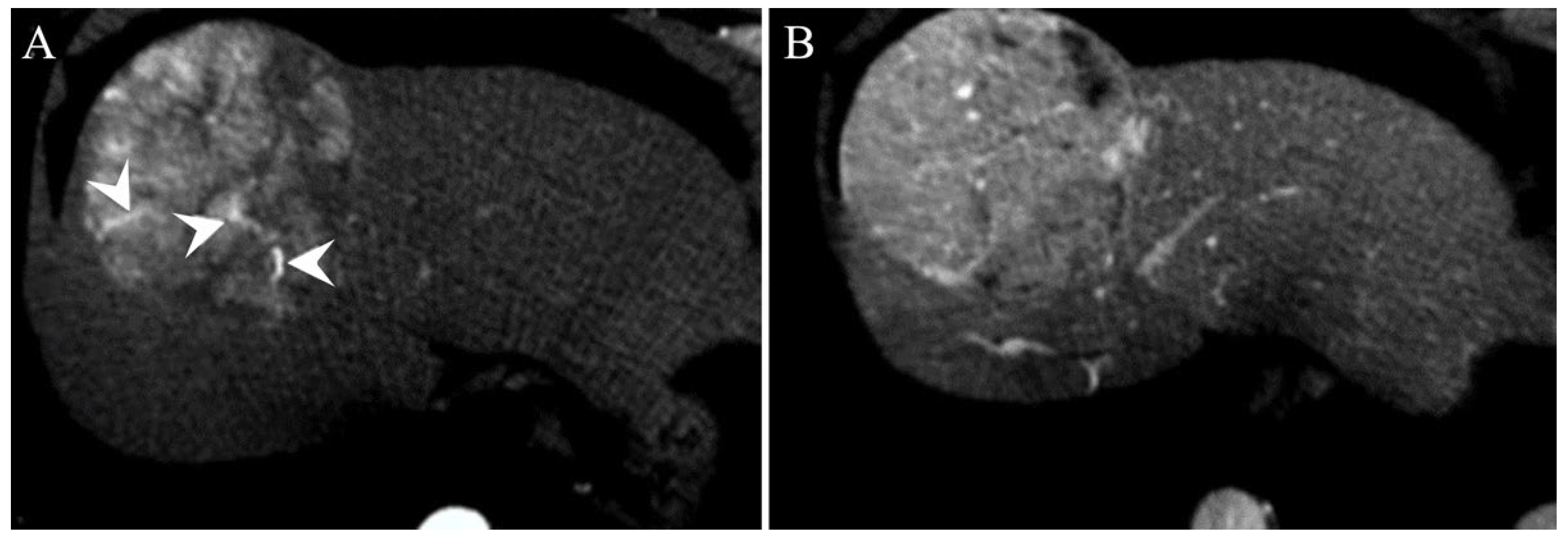 Gastroent 13 00028 g004