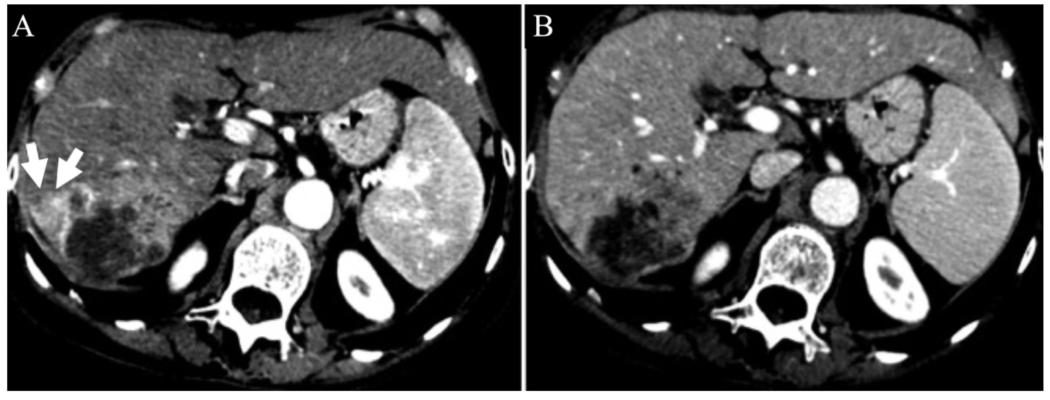 Gastroent 13 00028 g005