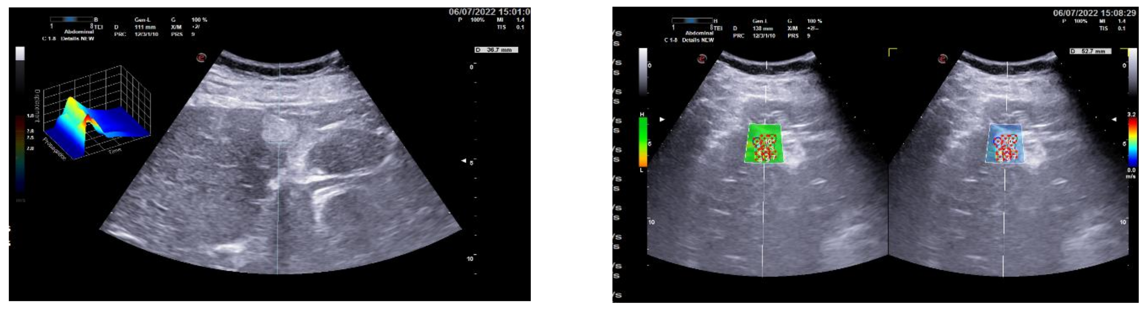 Gastroent 13 00030 g001