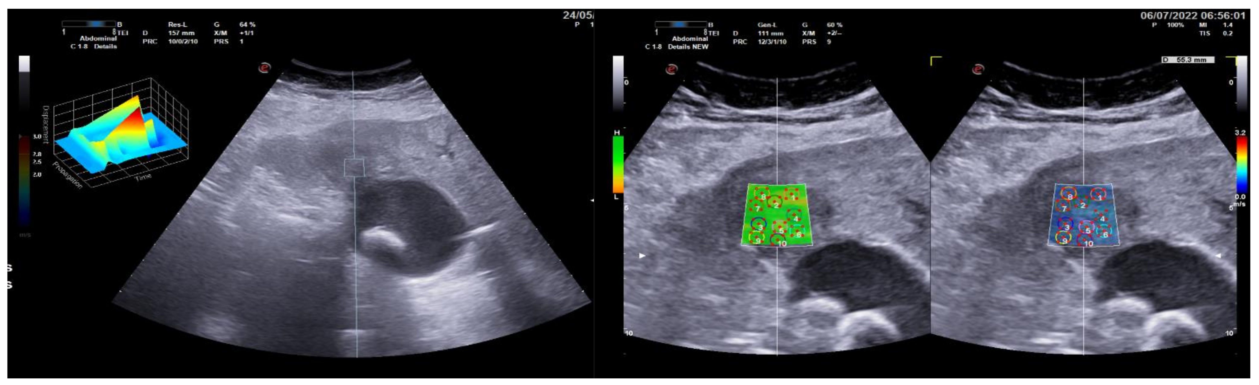 Gastroent 13 00030 g002