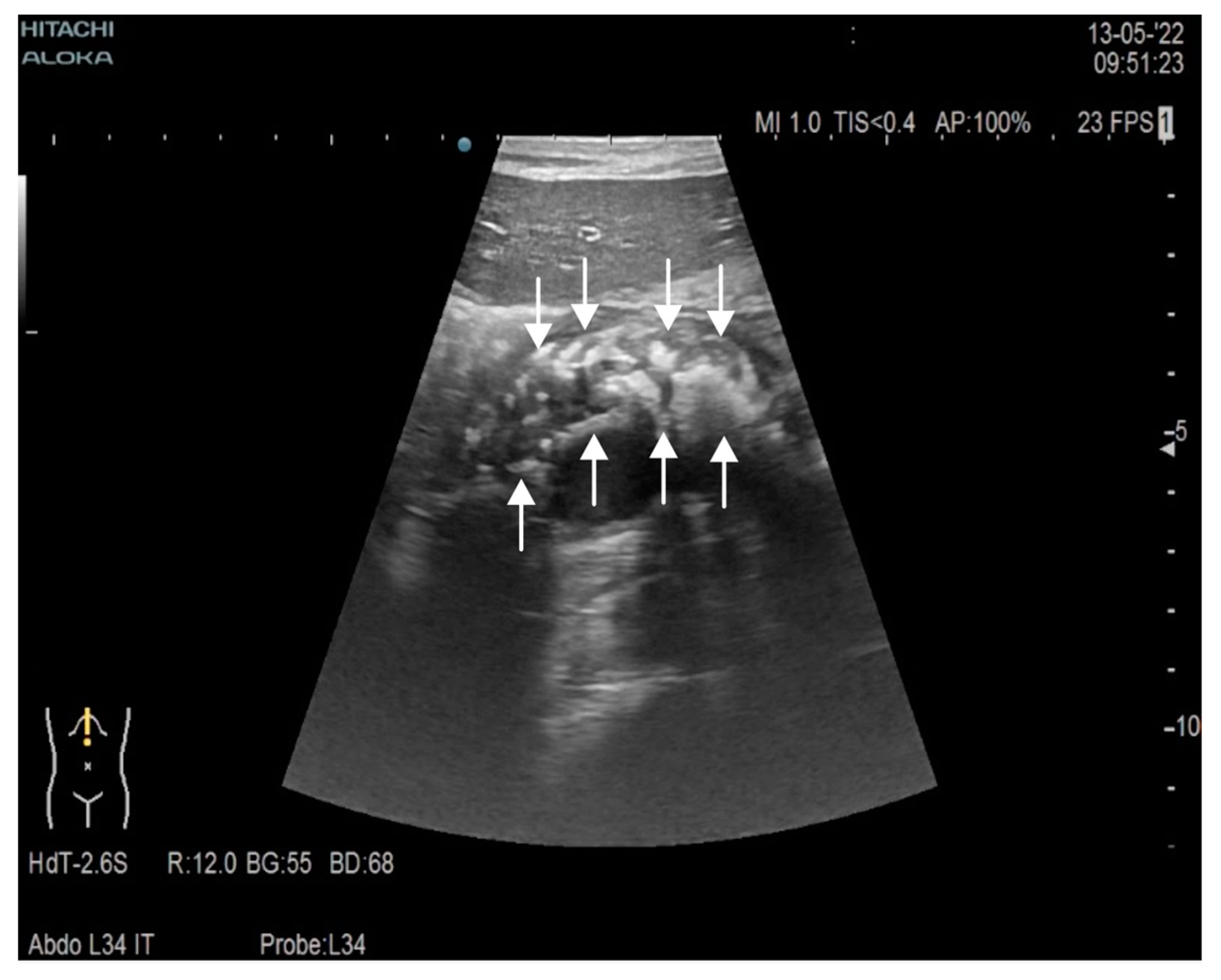 Gastroent 13 00031 g001