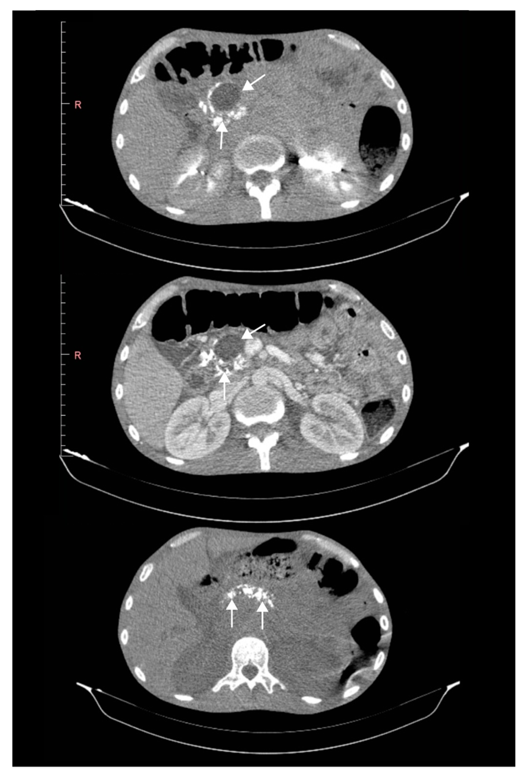 Gastroent 13 00031 g002