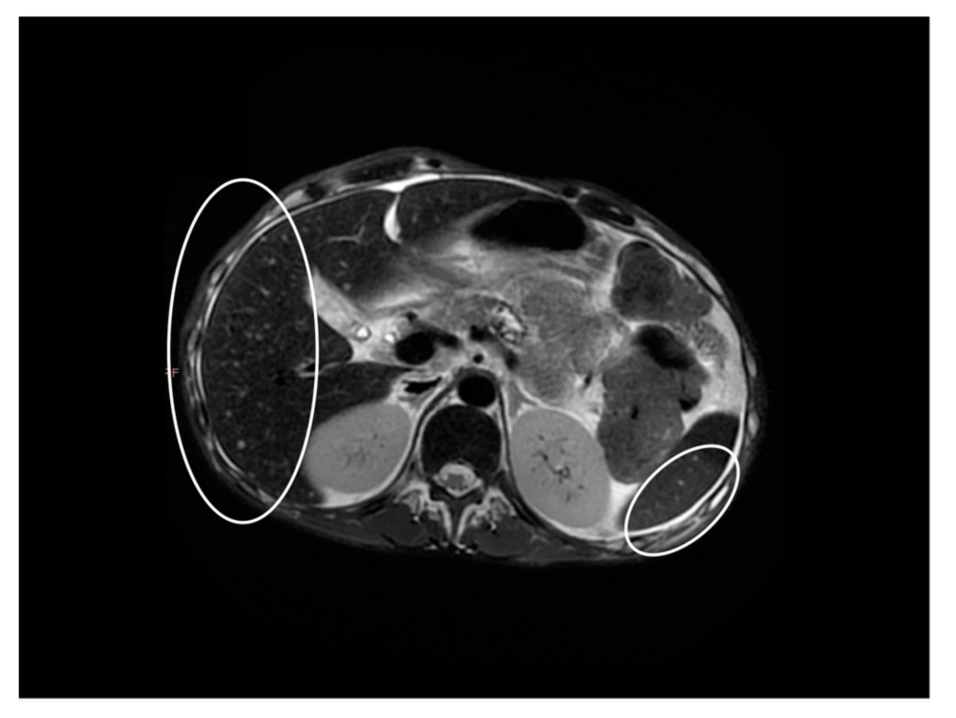 Gastroent 13 00031 g003