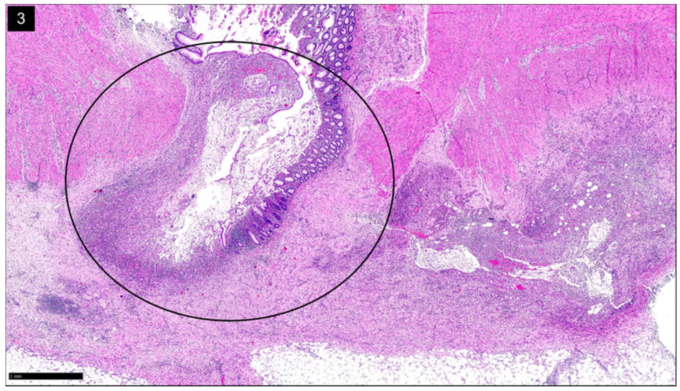 Gastroent 13 00033 g003