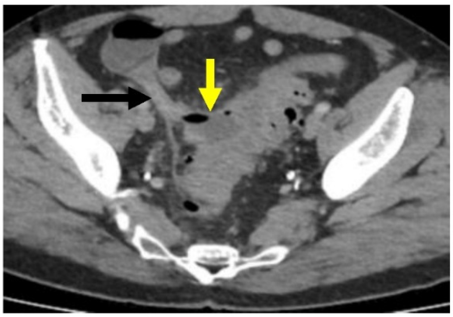 Gastroent 13 00033 g005