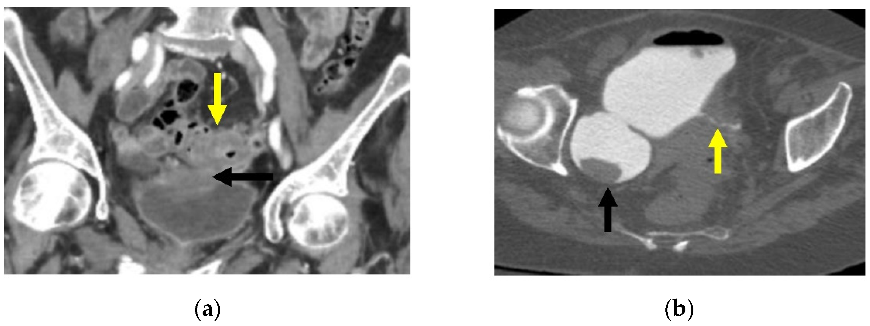Gastroent 13 00033 g007
