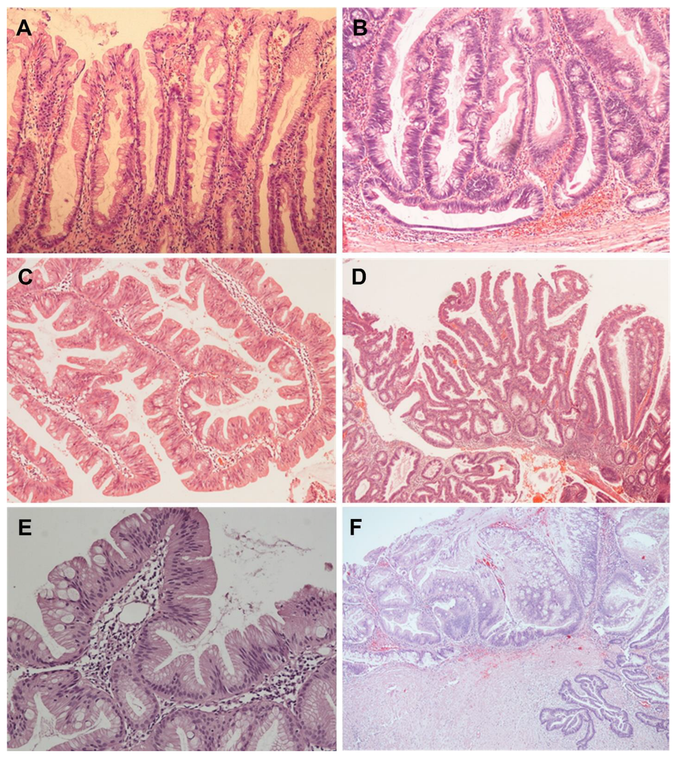 Gastroent 14 00008 g001 Gastroent 14 00008 g001