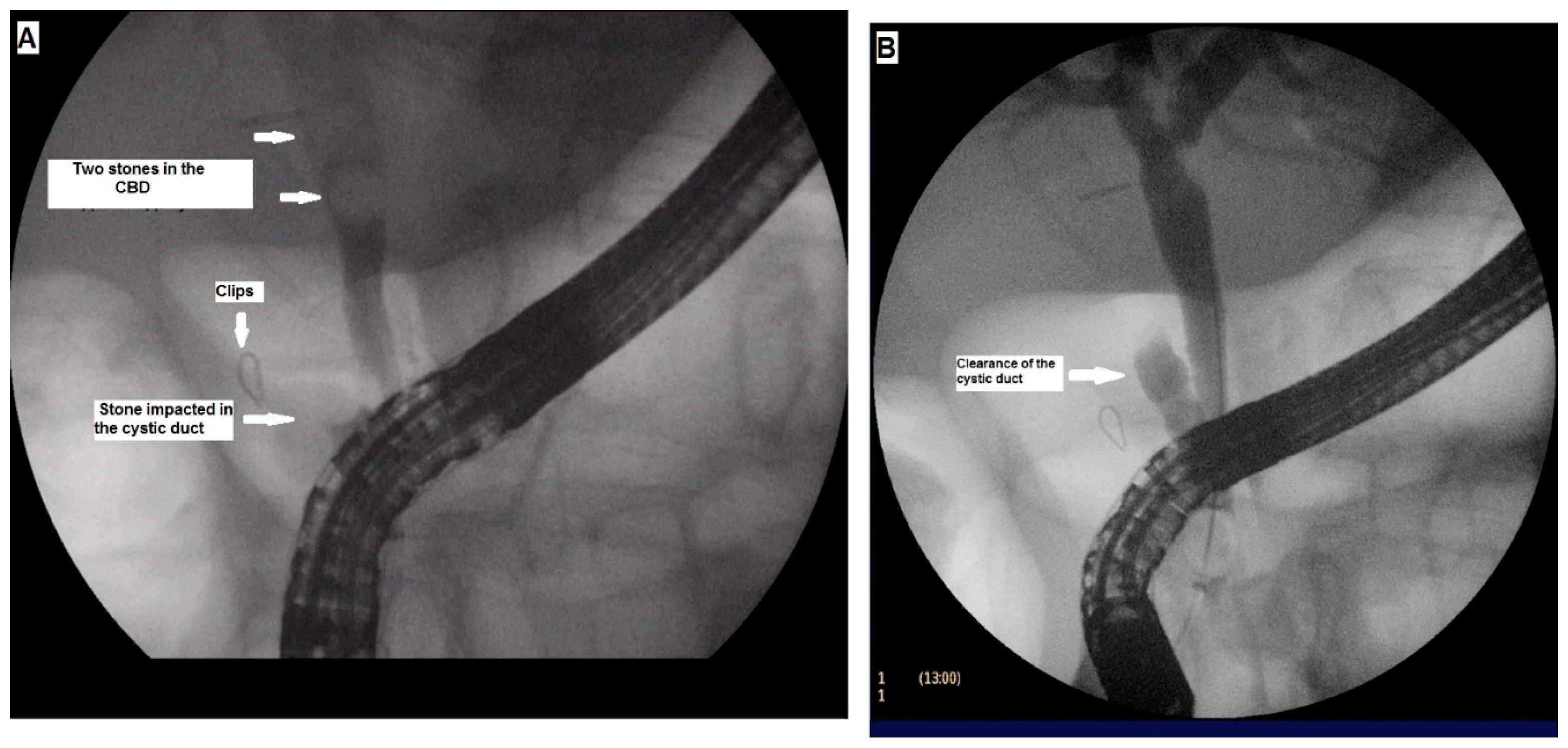 Gastroent 14 00009 g003