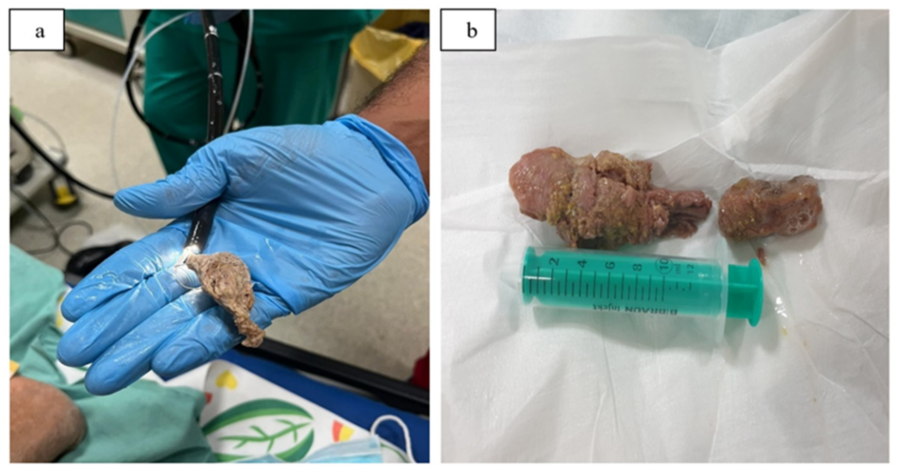 Gastroent 14 00010 g001 Gastroent 14 00010 g001