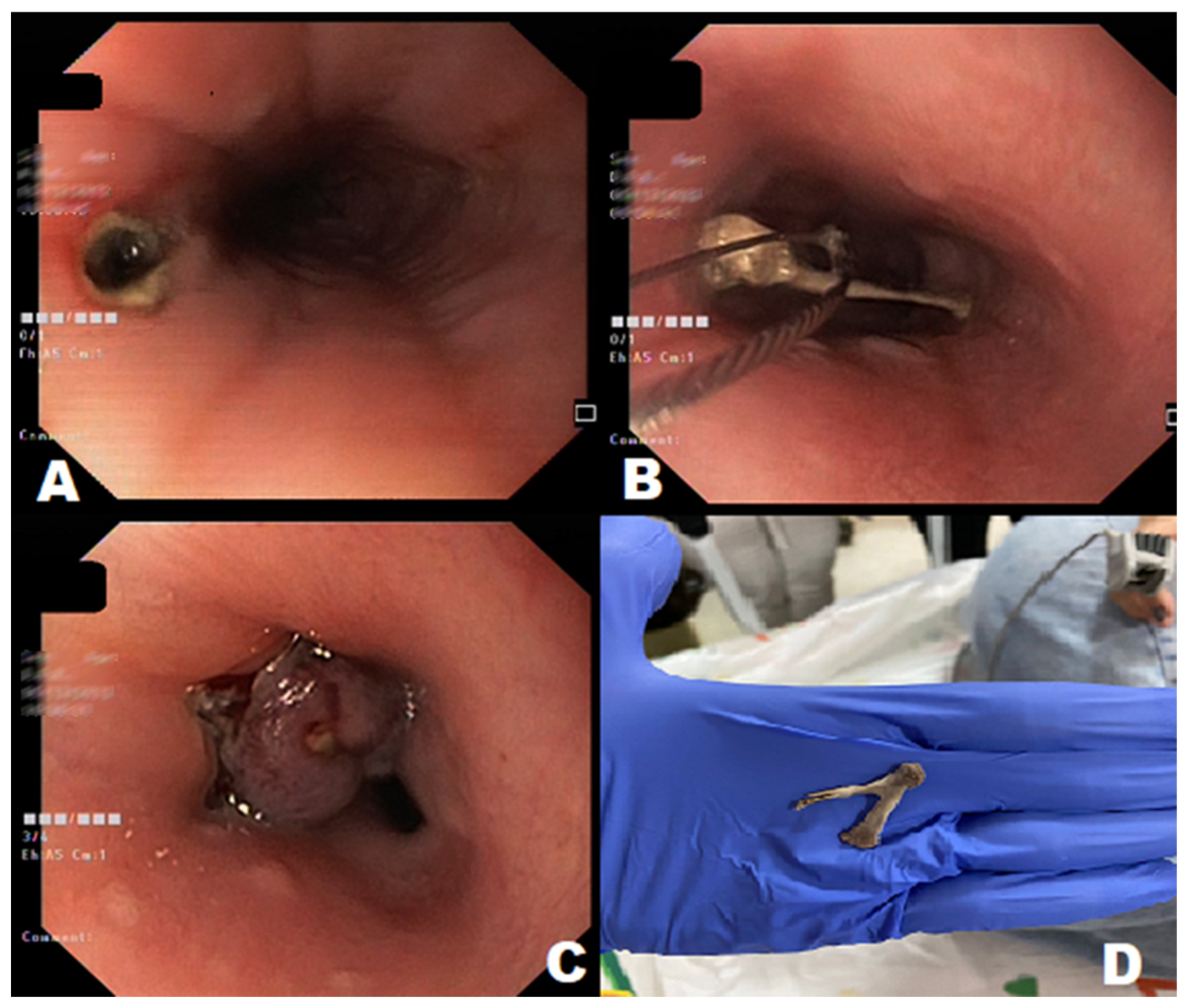 Gastroent 14 00010 g002 Gastroent 14 00010 g002
