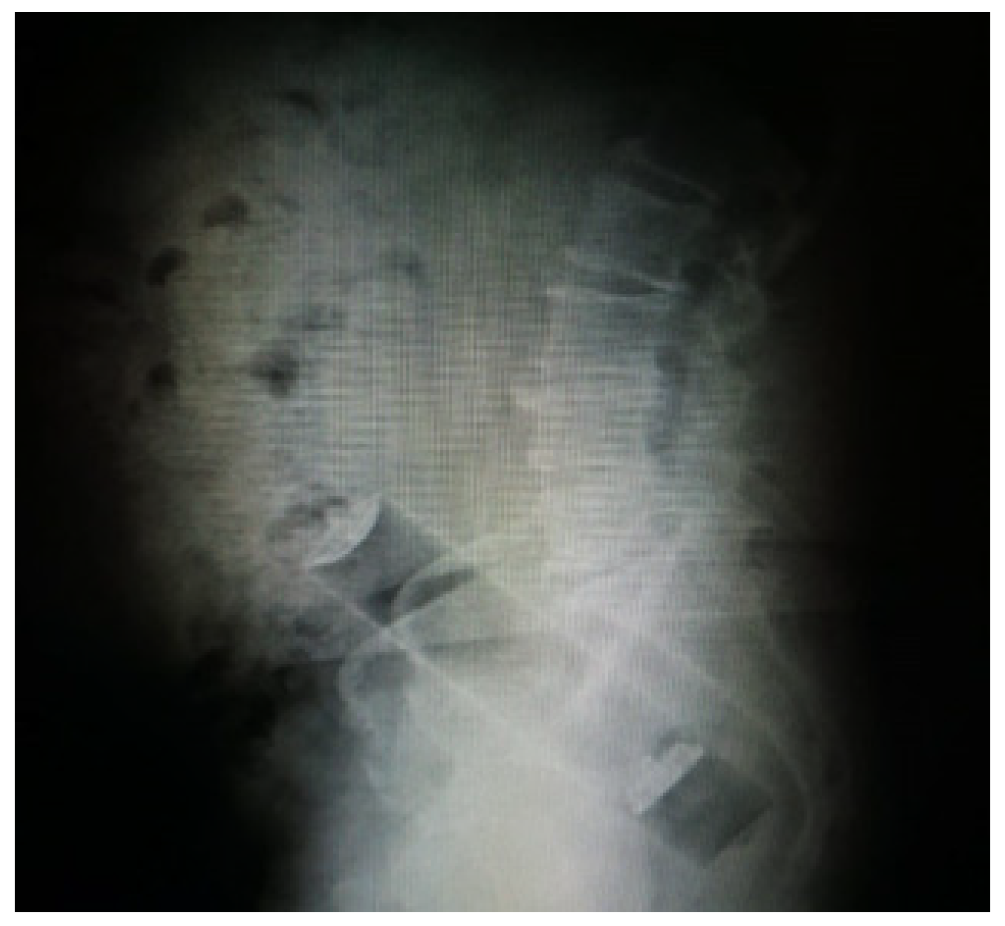 Gastroent 14 00010 g004 Gastroent 14 00010 g004