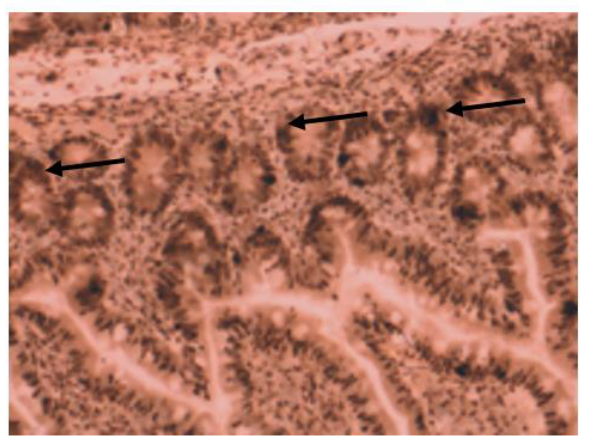 Gastroent 14 00025 g003 Gastroent 14 00025 g003