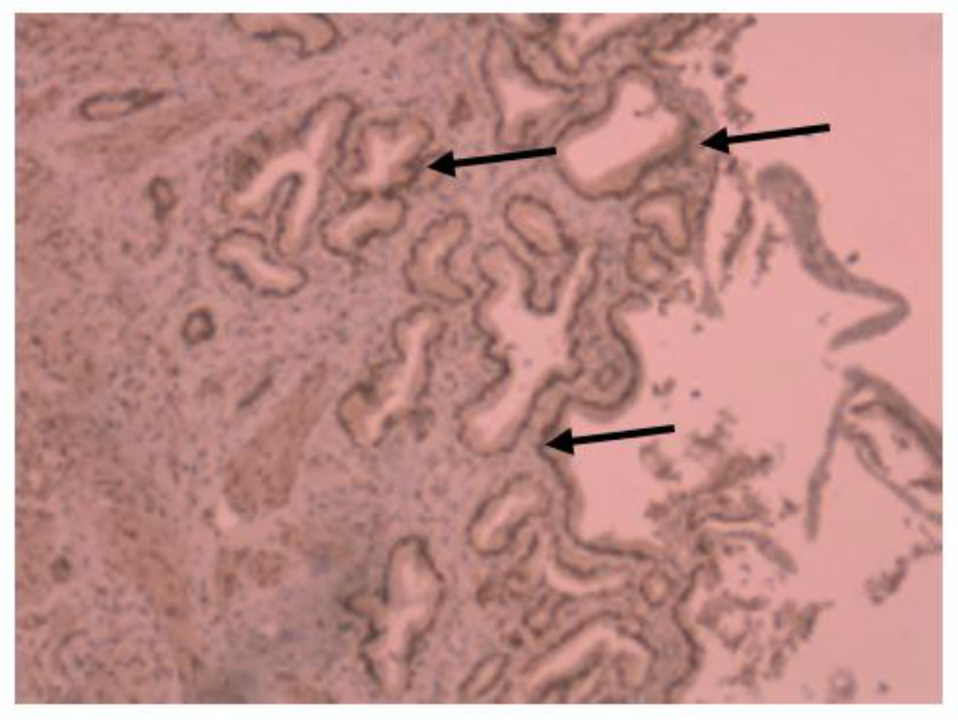 Gastroent 14 00025 g004 Gastroent 14 00025 g004