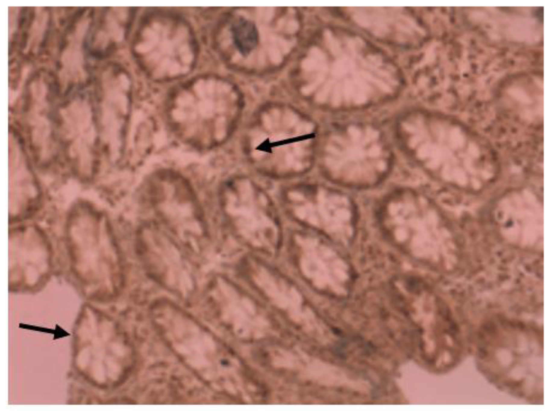 Gastroent 14 00025 g005 Gastroent 14 00025 g005