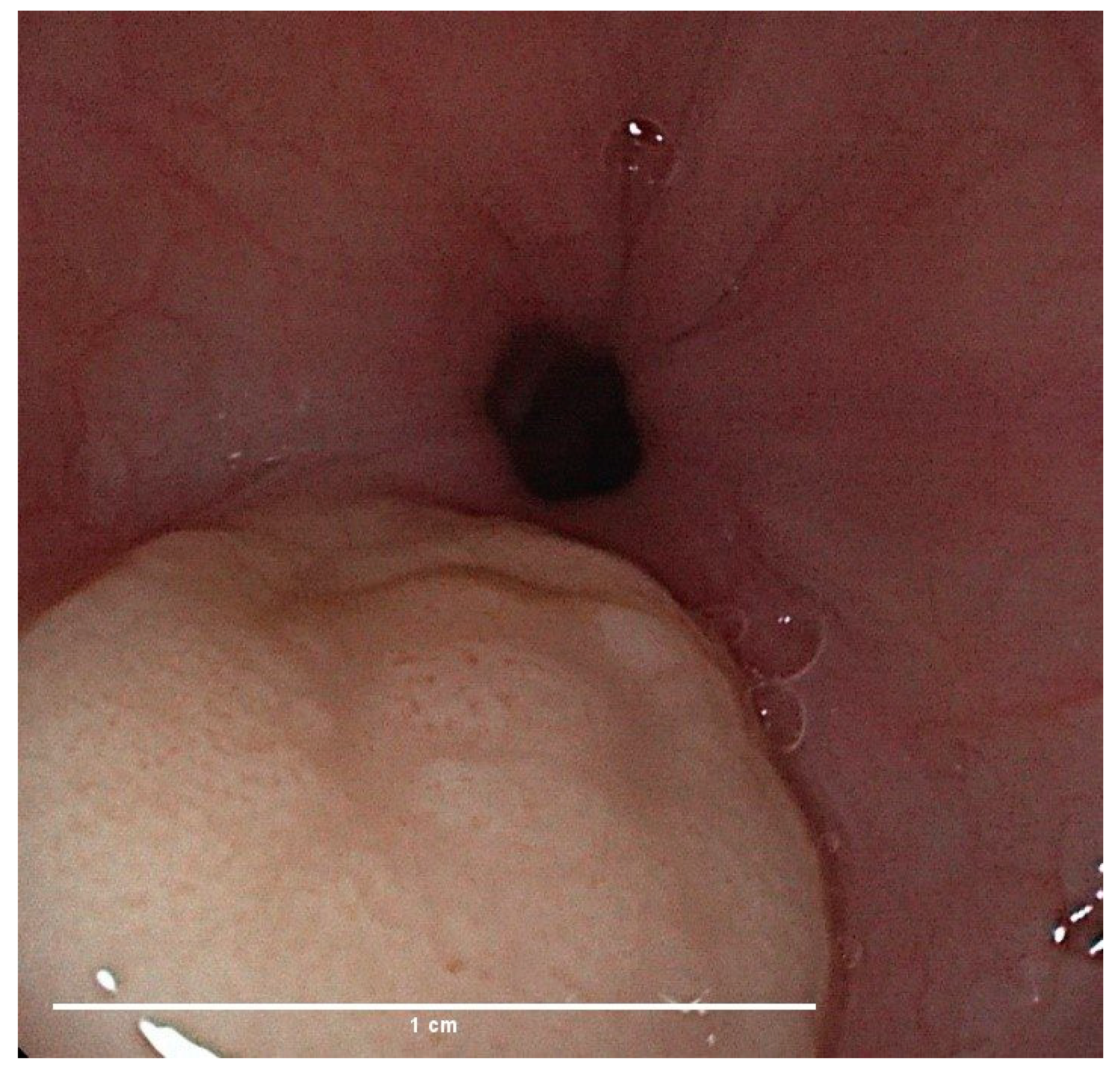Gastroent 15 00018 g001