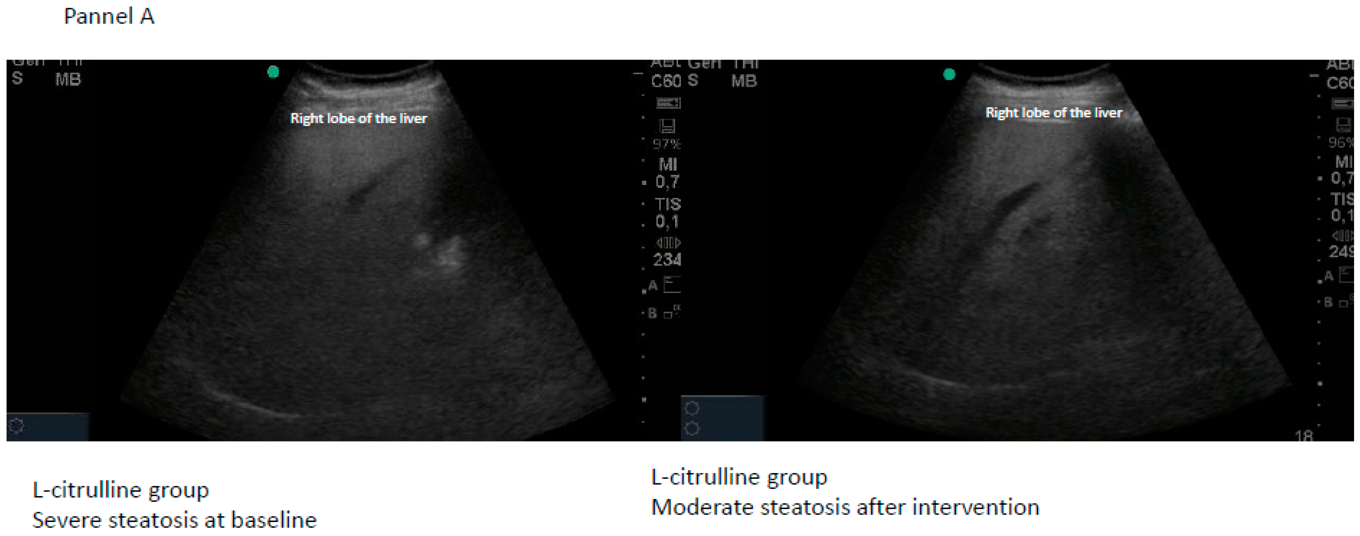 Gastroent 15 00024 g004a
