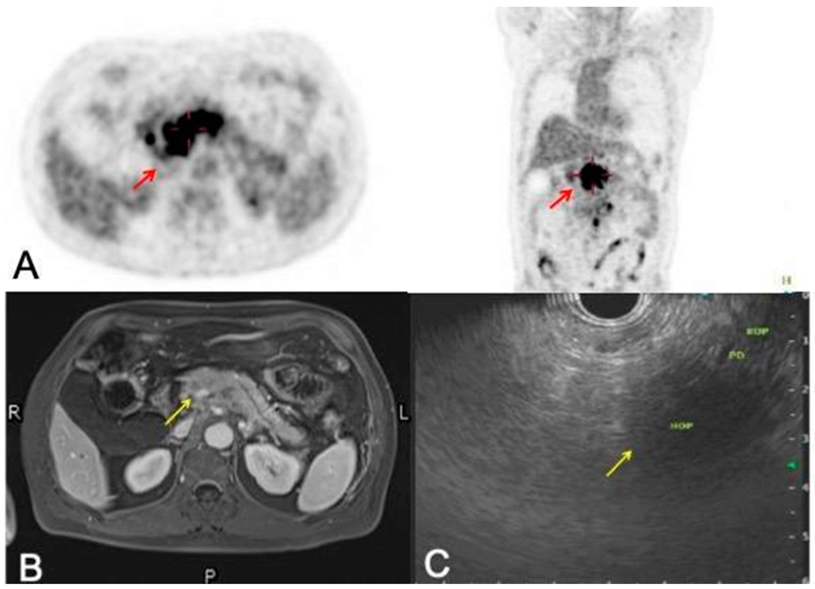 Gastroent 15 00026 g003