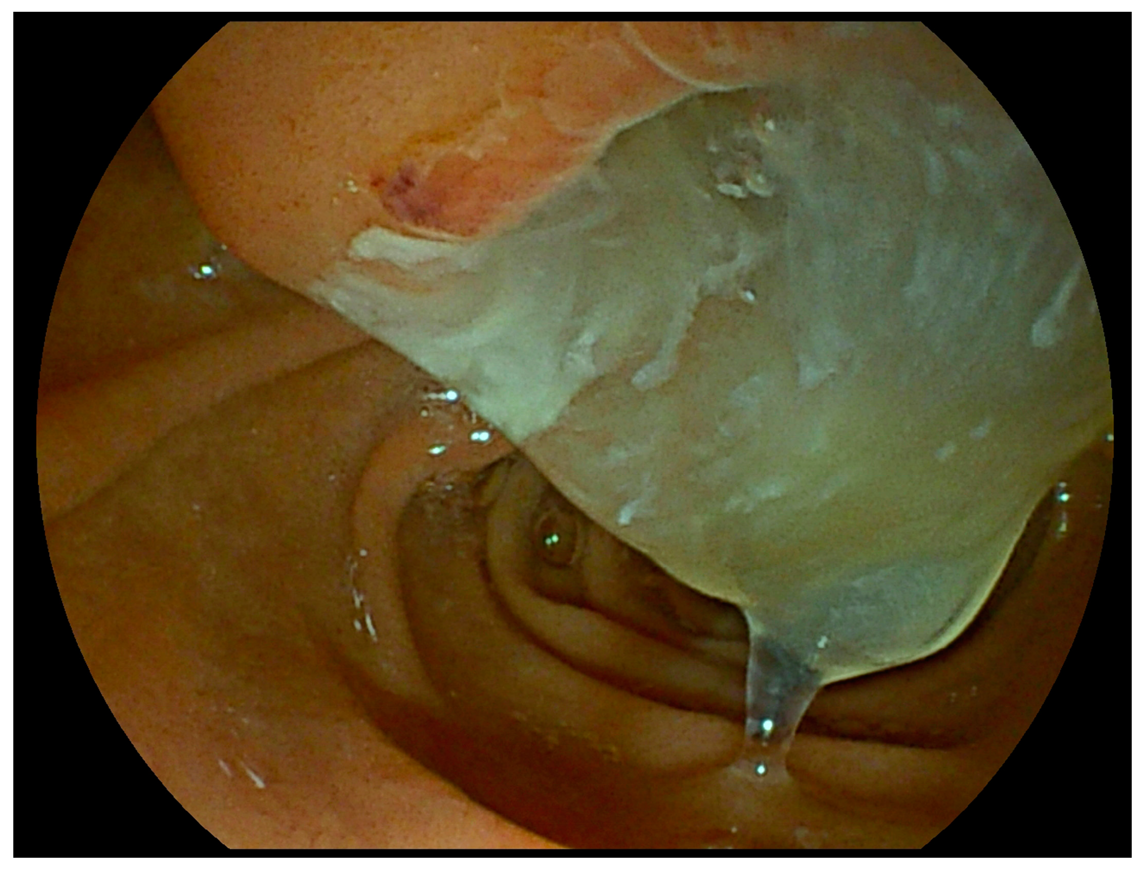 Gastroent 15 00057 g003