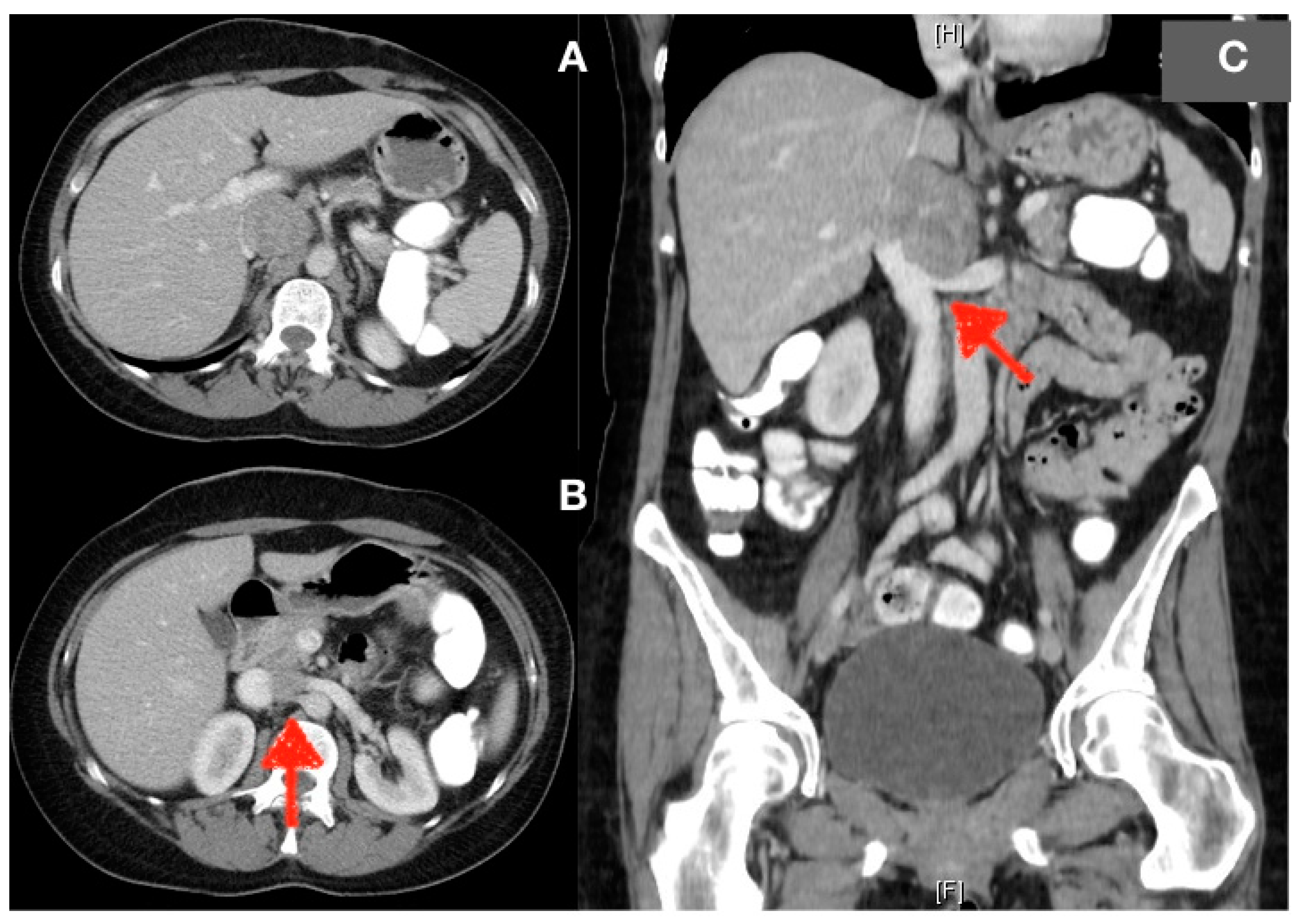 Gastroent 15 00060 g001 Gastroent 15 00060 g001