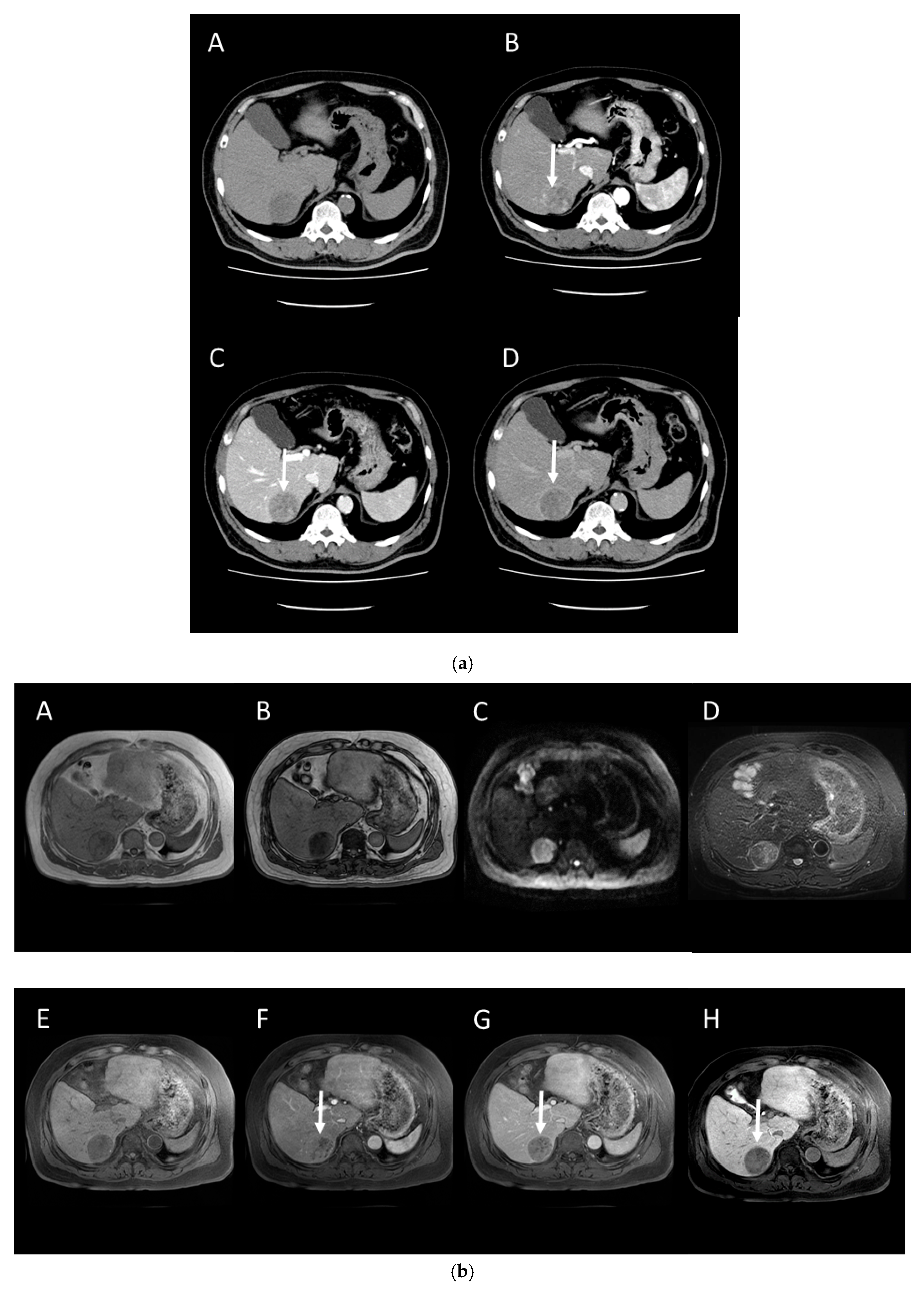 Gastroent 15 00068 g002