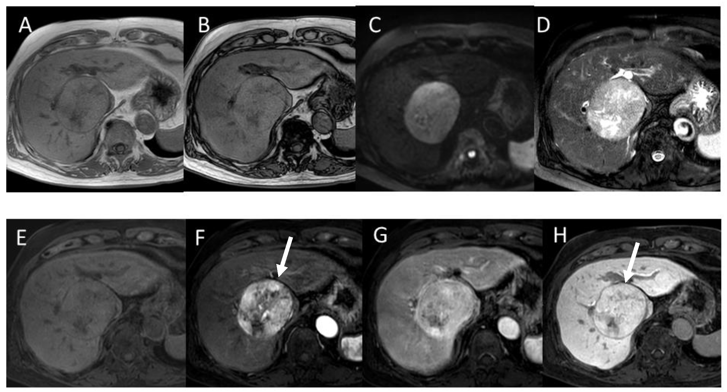 Gastroent 15 00068 g003