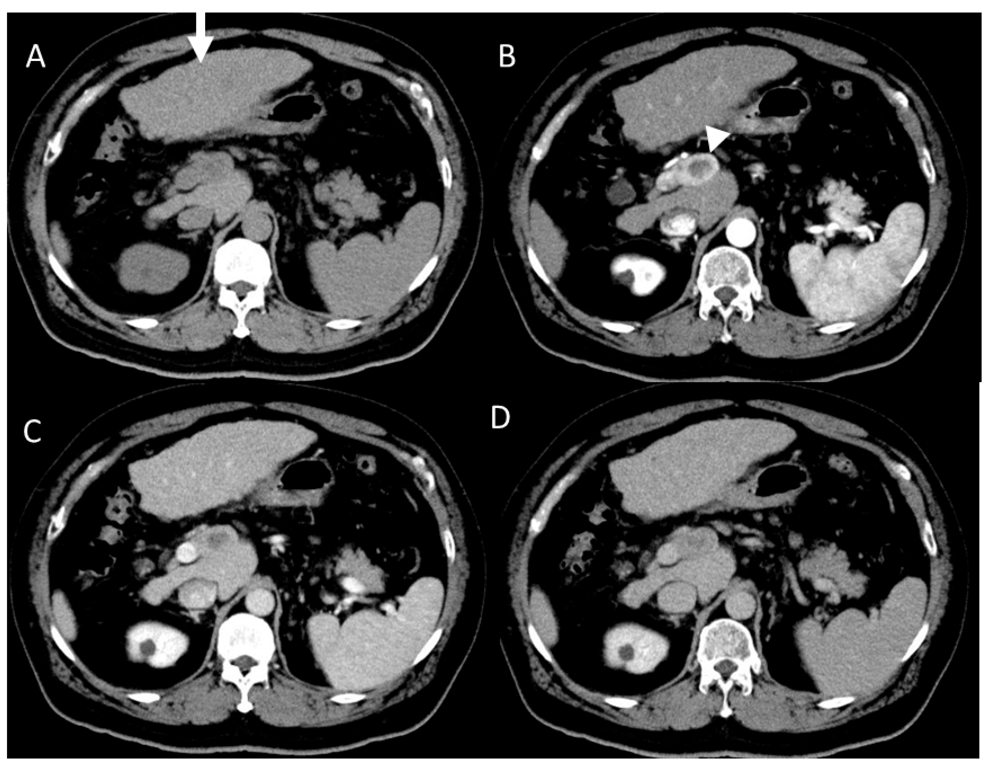 Gastroent 15 00068 g005