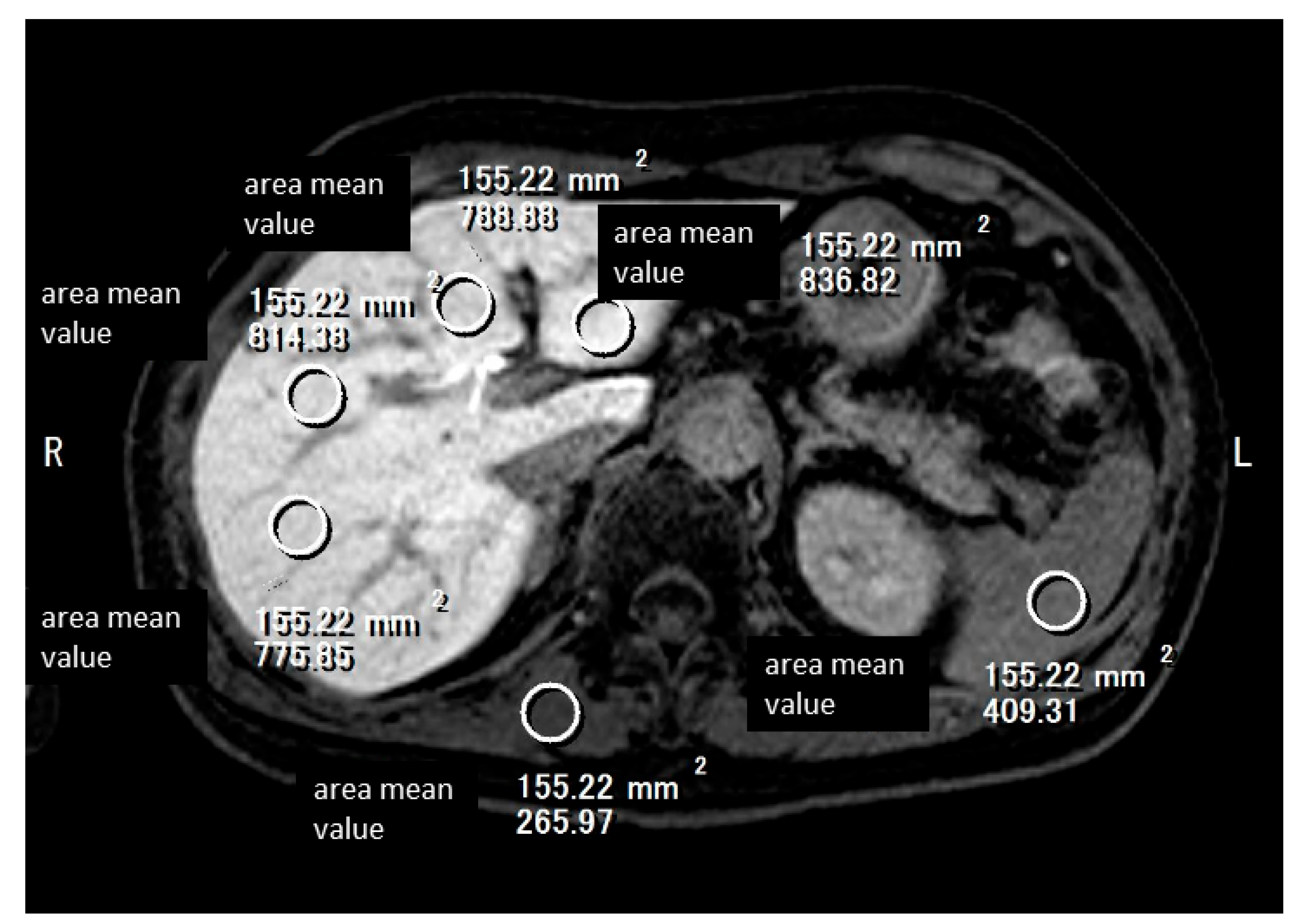 Gastroent 15 00068 g009