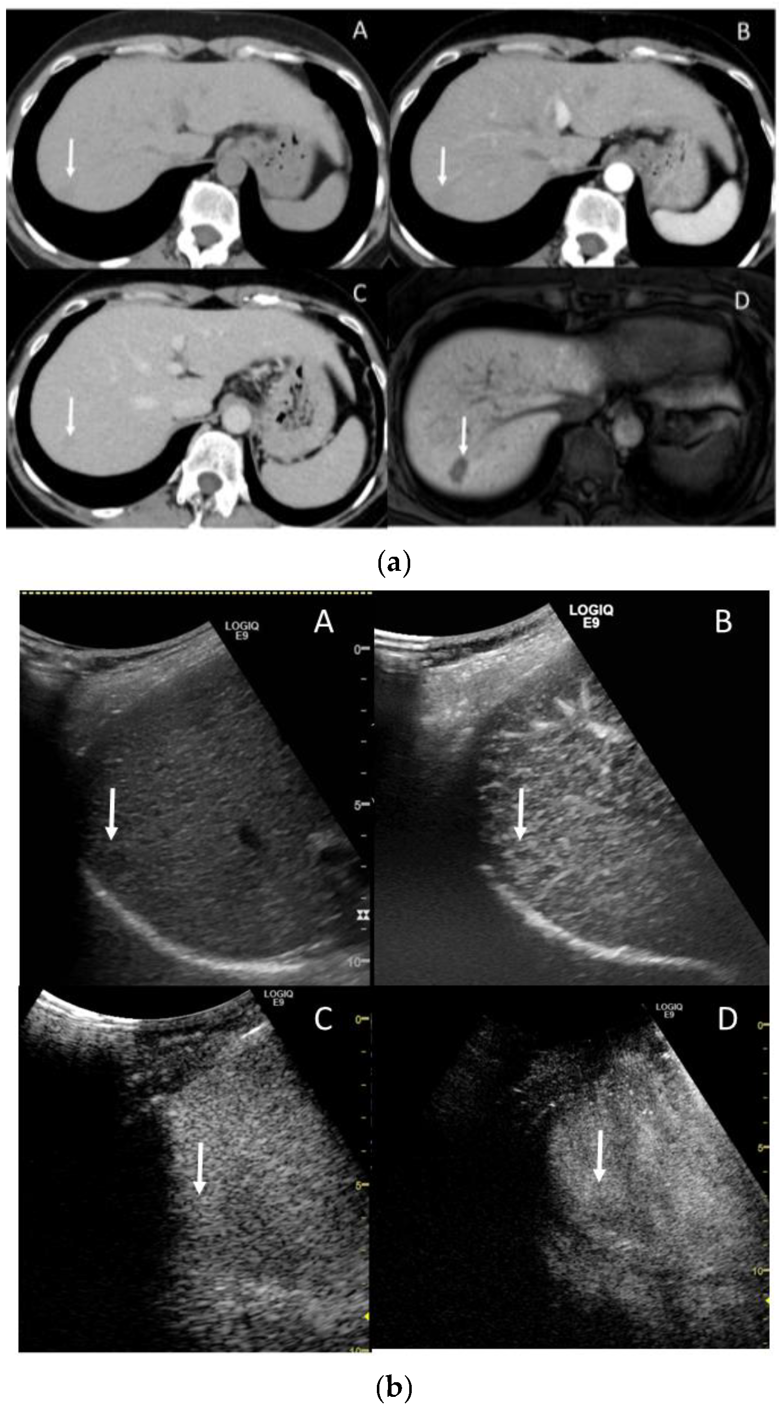 Gastroent 15 00068 g010
