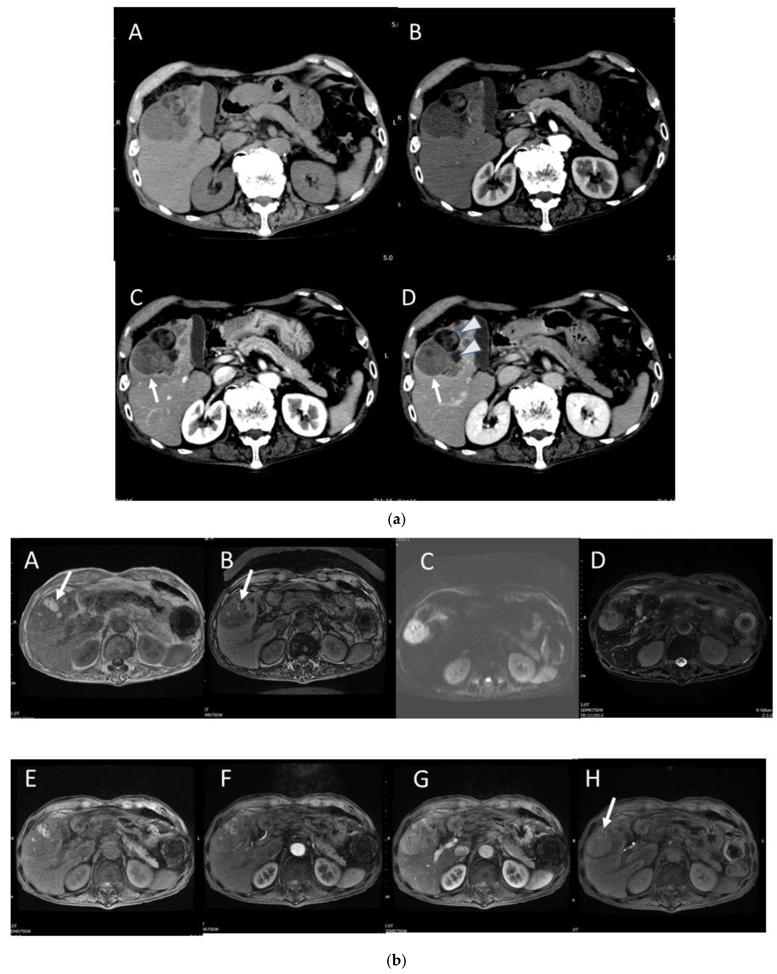 Gastroent 15 00068 g011