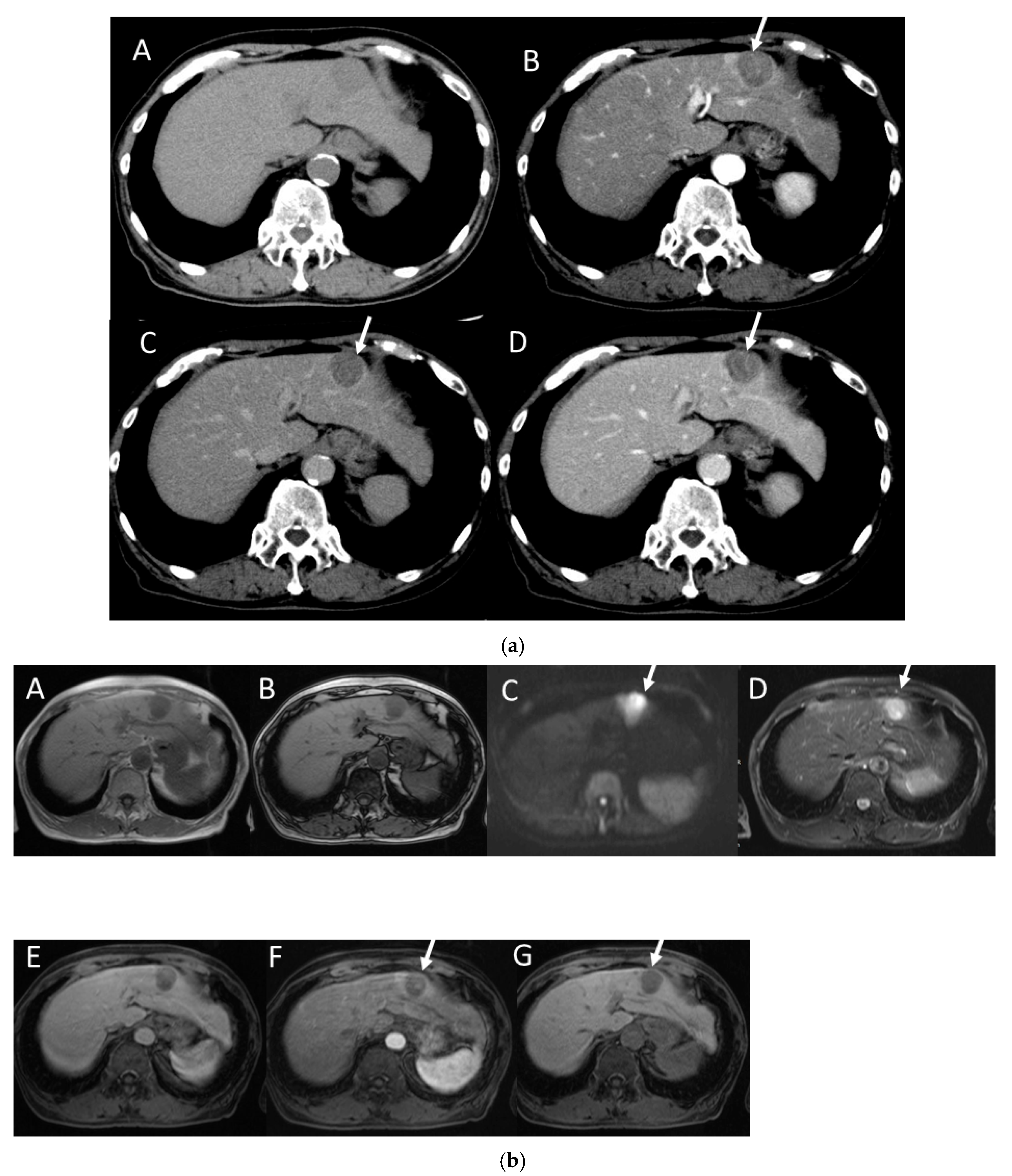 Gastroent 15 00068 g013