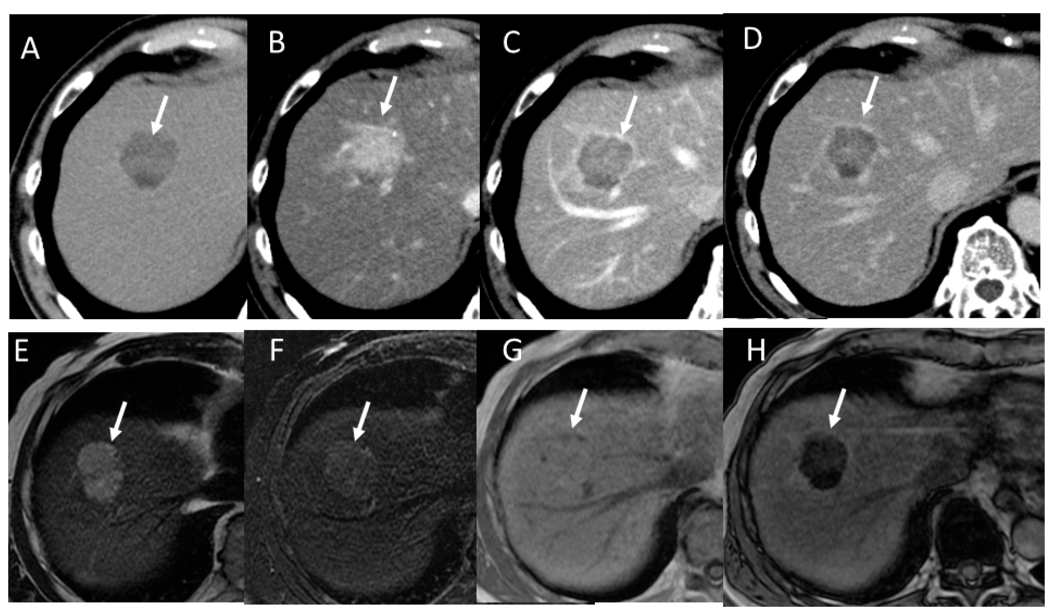 Gastroent 15 00068 g016
