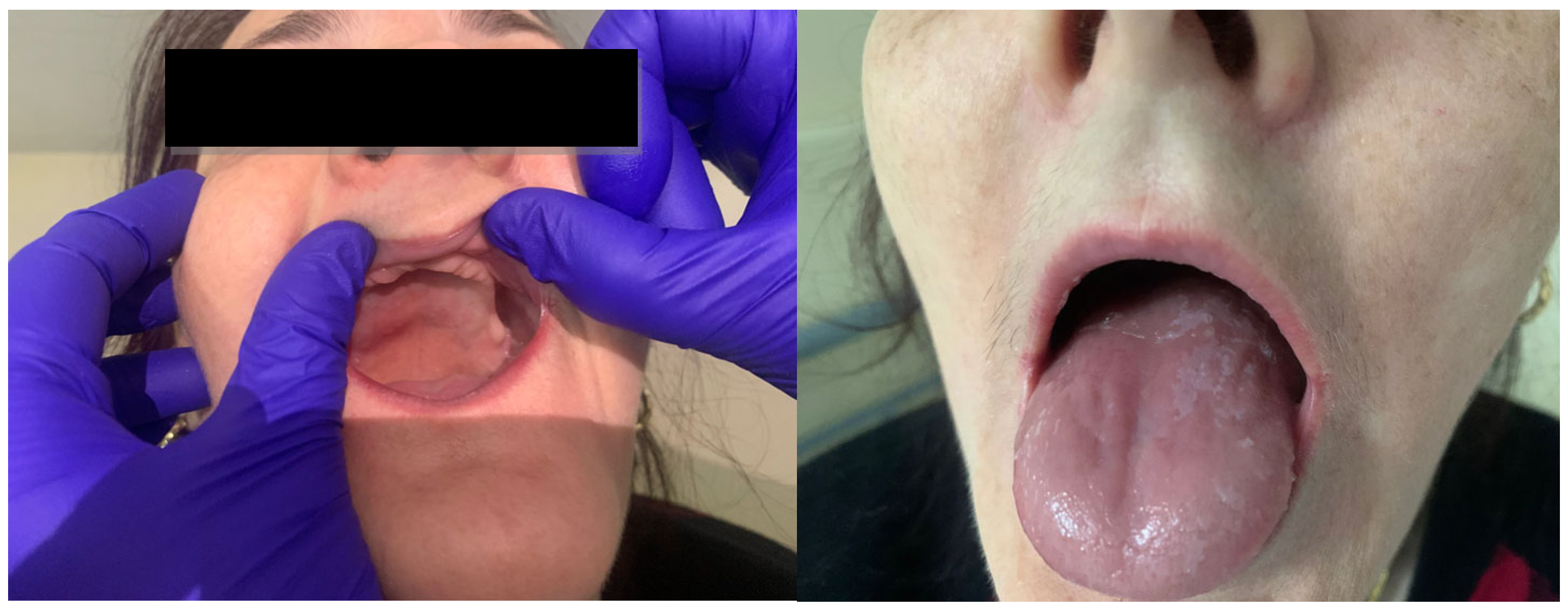 Gastroent 16 00011 g001