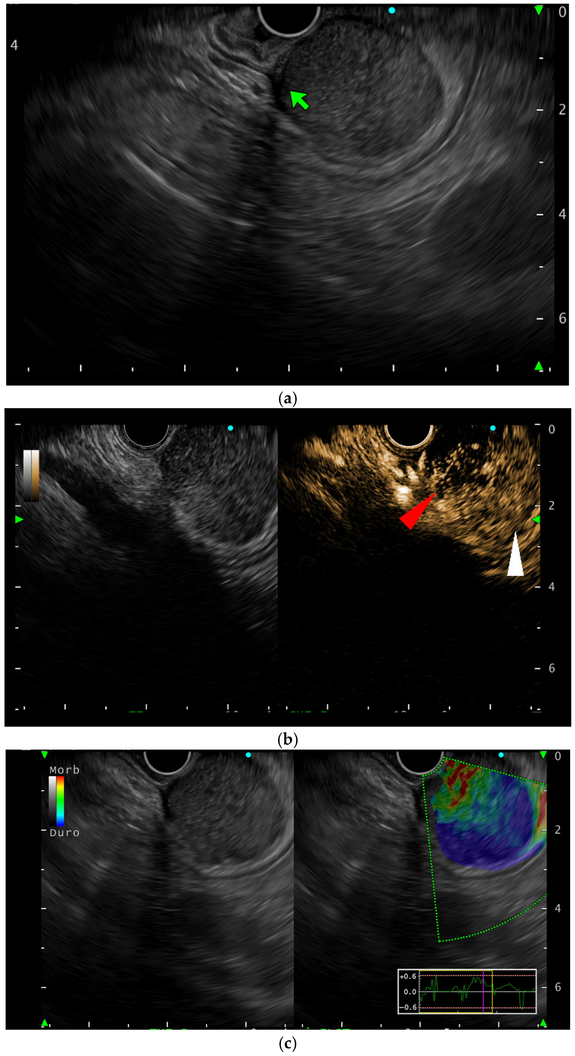 Gastroent 17 00002 g002