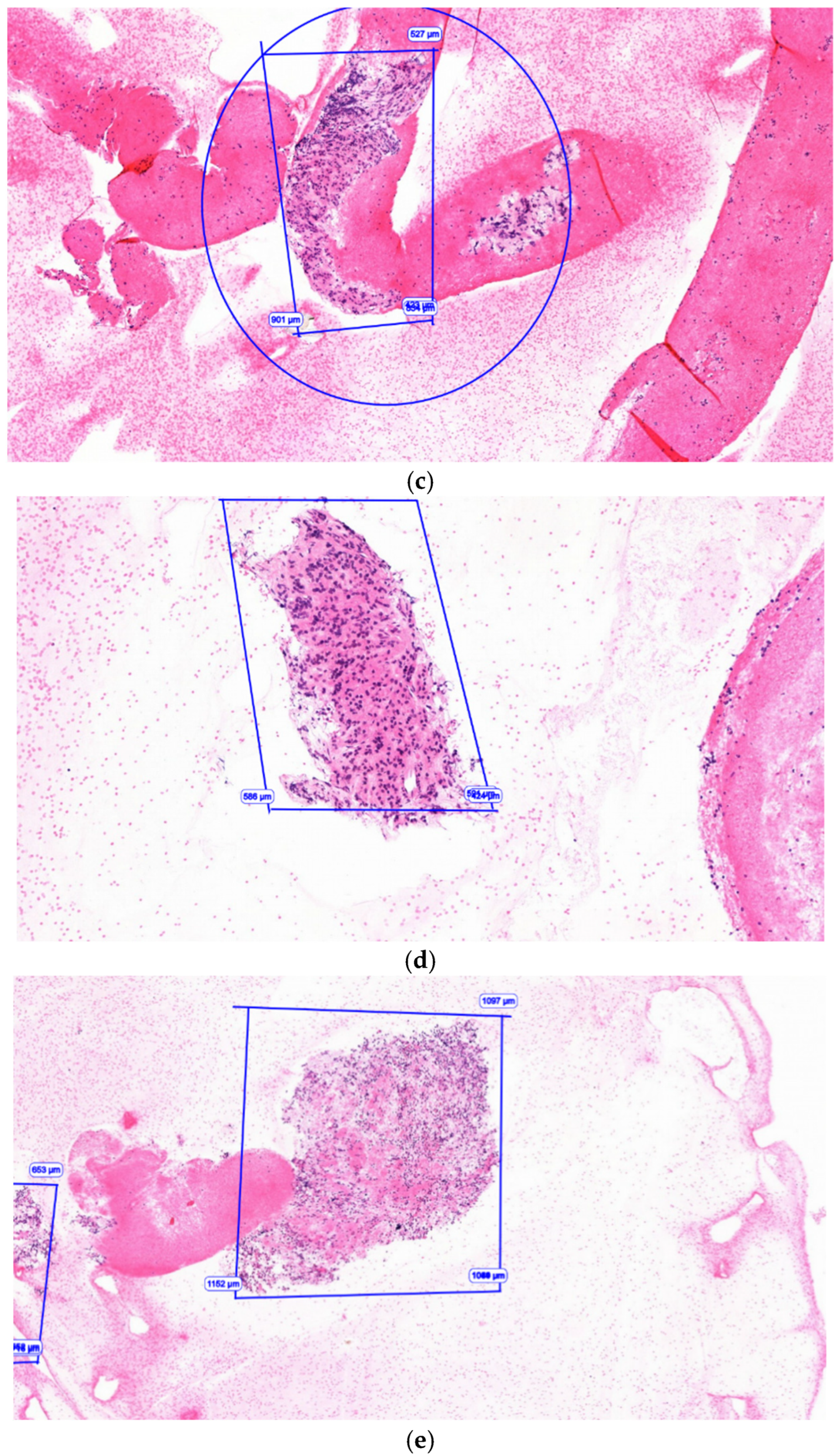Gastroent 17 00002 g003b