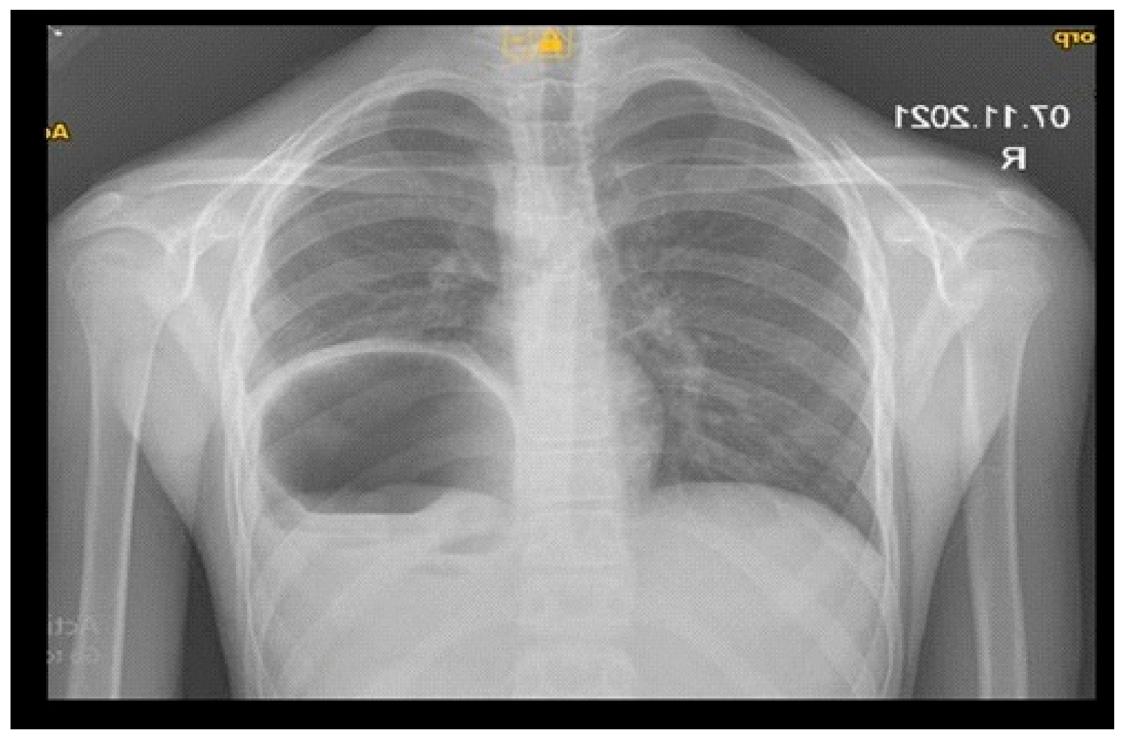 Gastroent 17 00047 g001 Gastroent 17 00047 g001