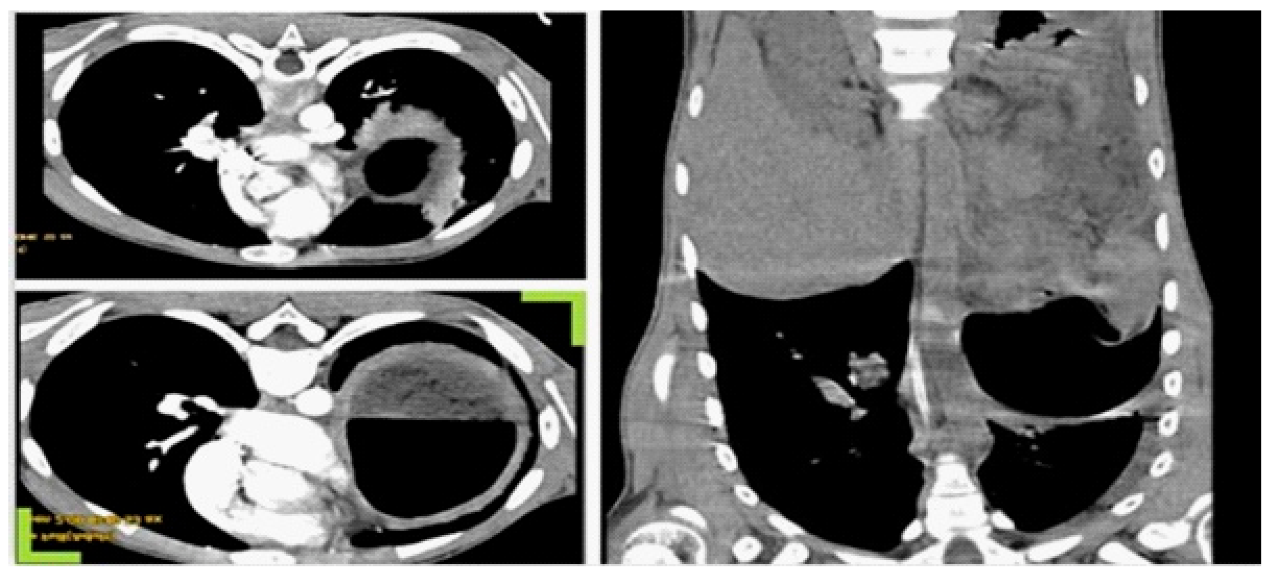Gastroent 17 00047 g002 Gastroent 17 00047 g002