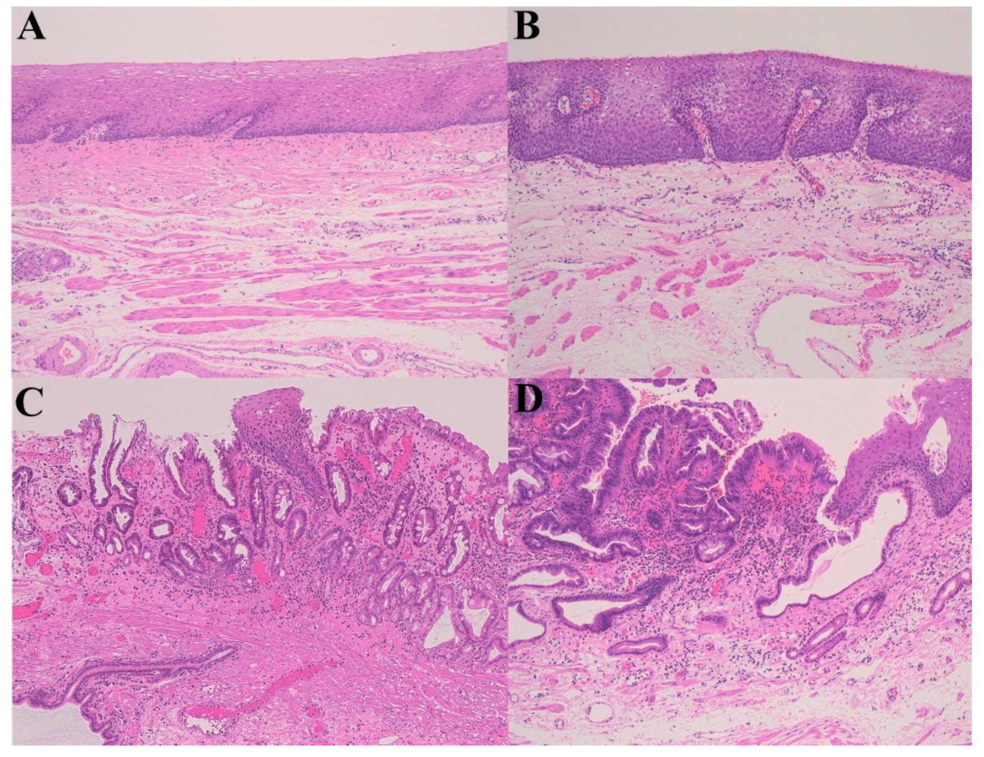 Gastrointestdisord 01 00028 g002
