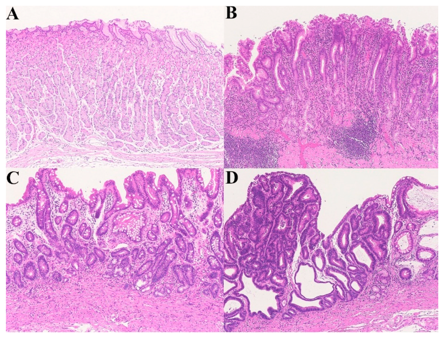 Gastrointestdisord 01 00028 g003
