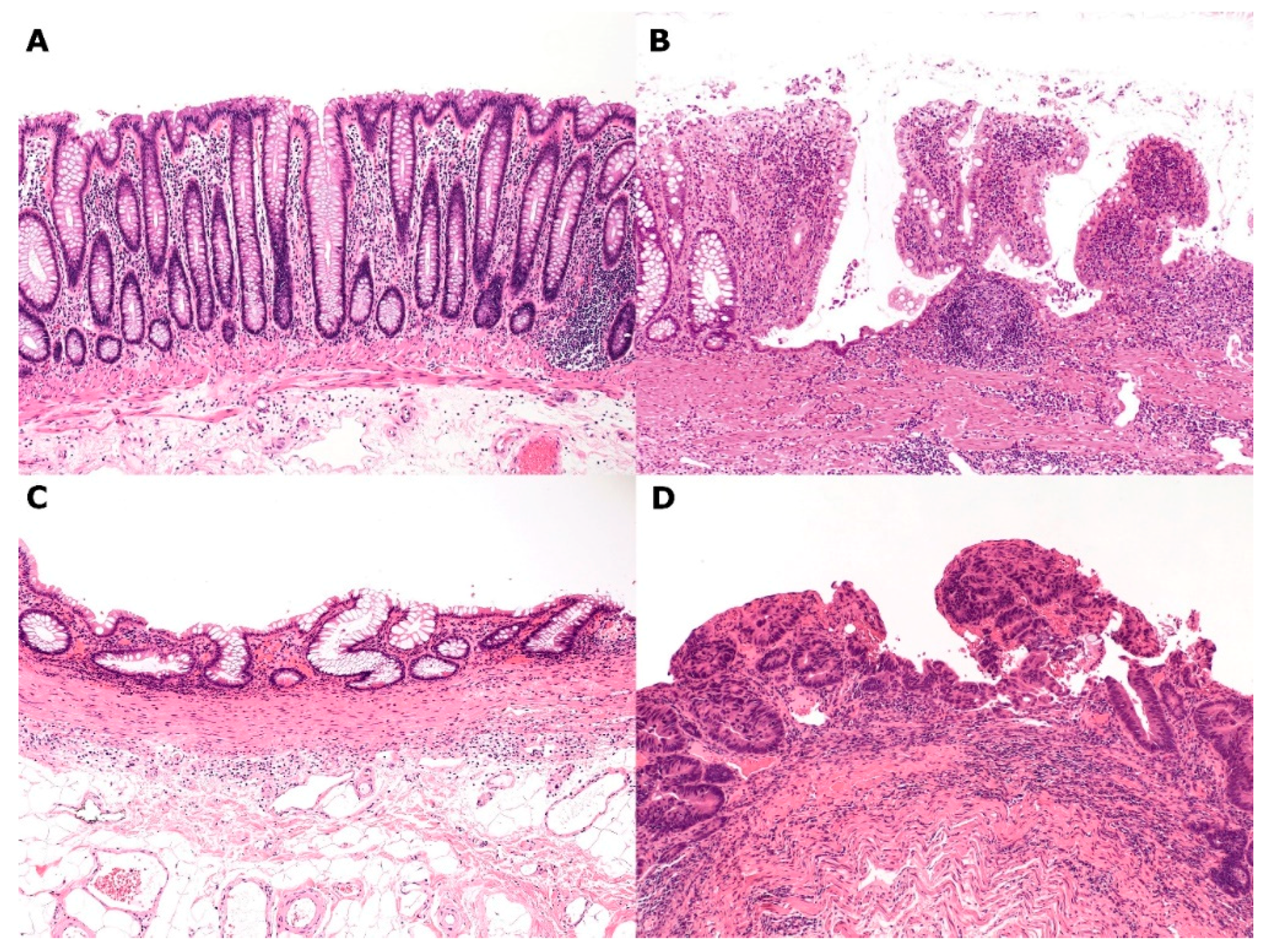Gastrointestdisord 01 00028 g004