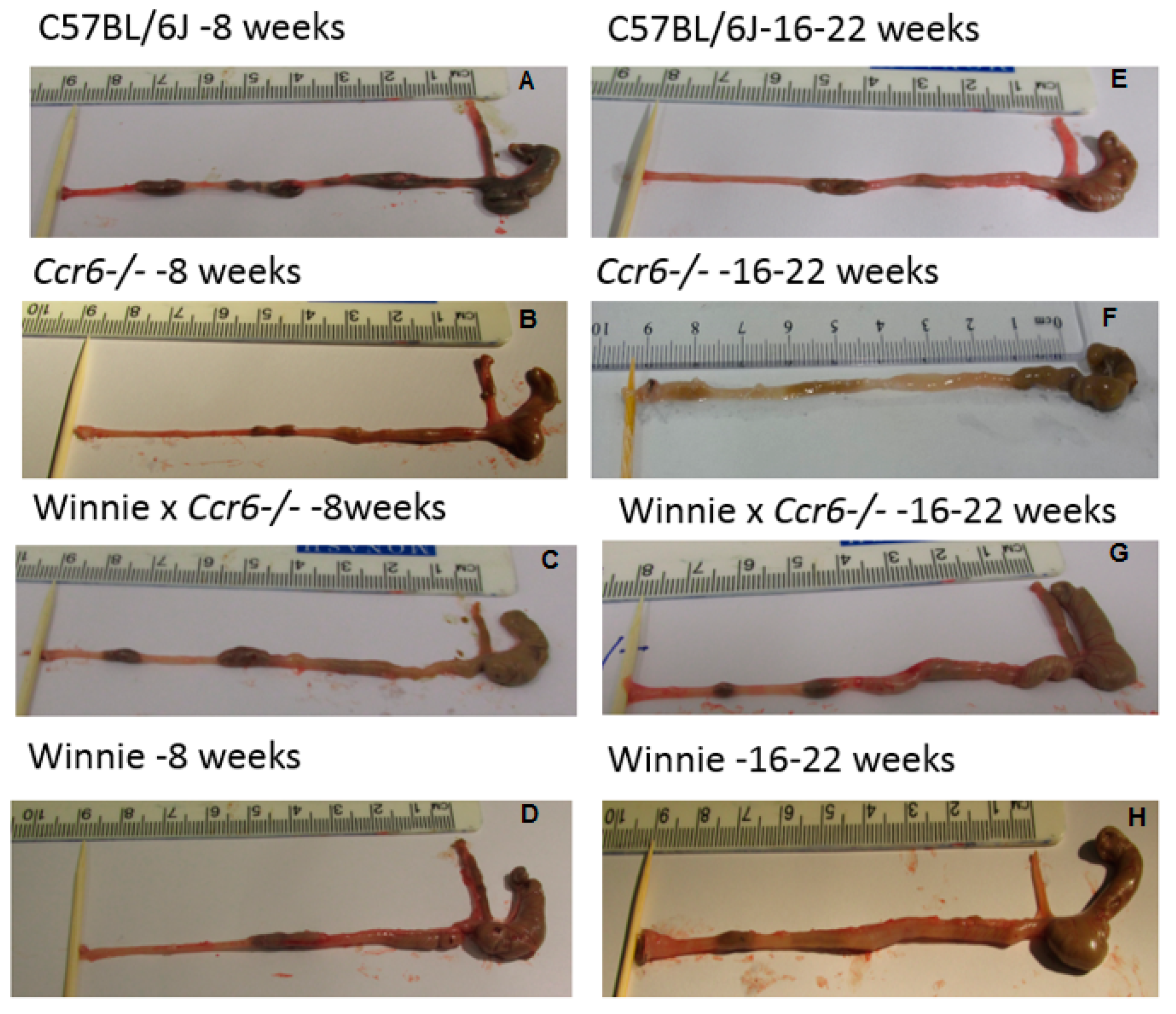 Gastrointestdisord 02 00004 g002