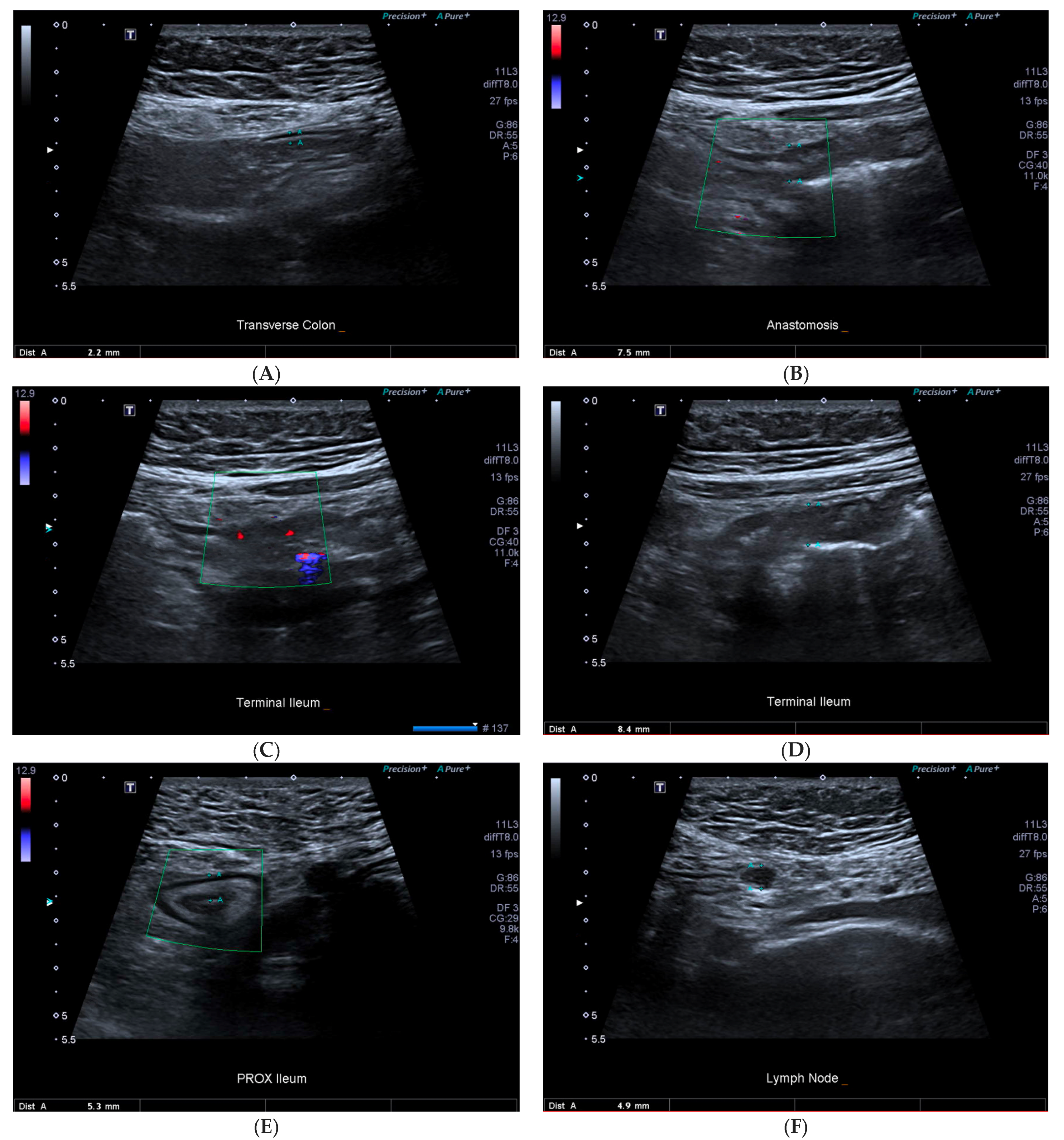 Gastrointestdisord 04 00024 g001