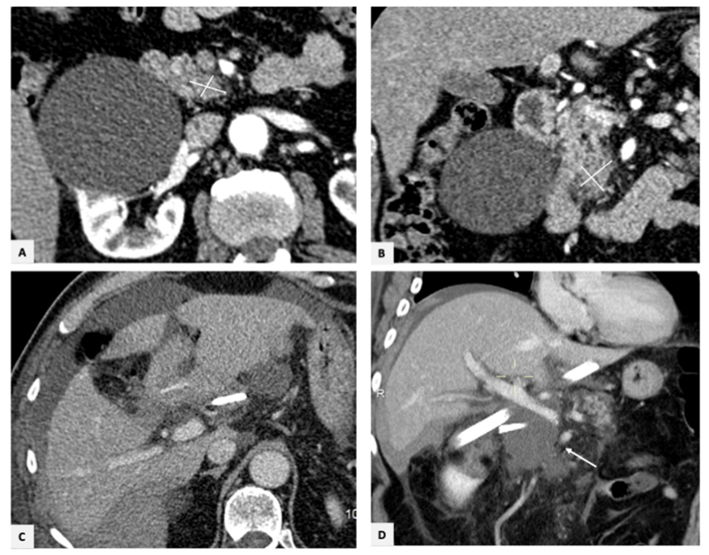 Gastrointestdisord 05 00007 g001