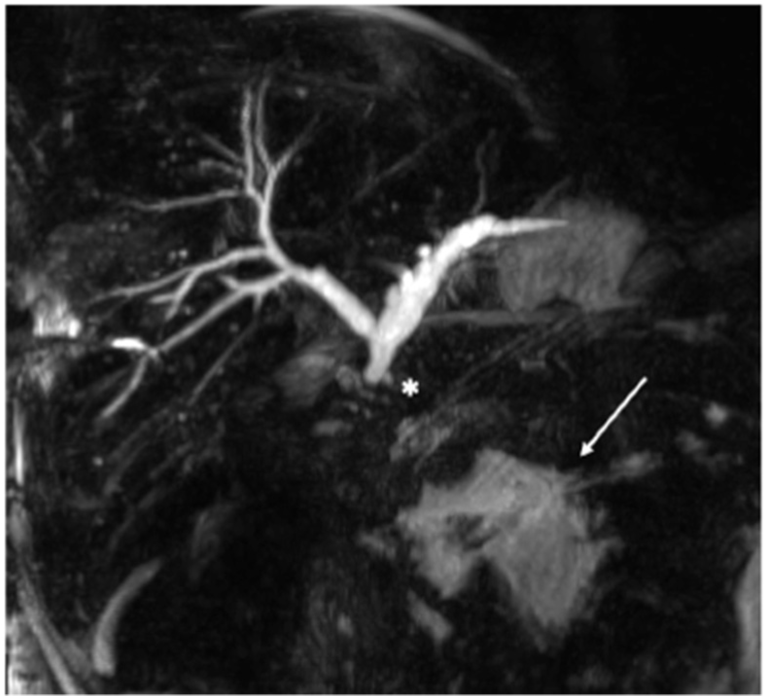 Gastrointestdisord 05 00007 g002