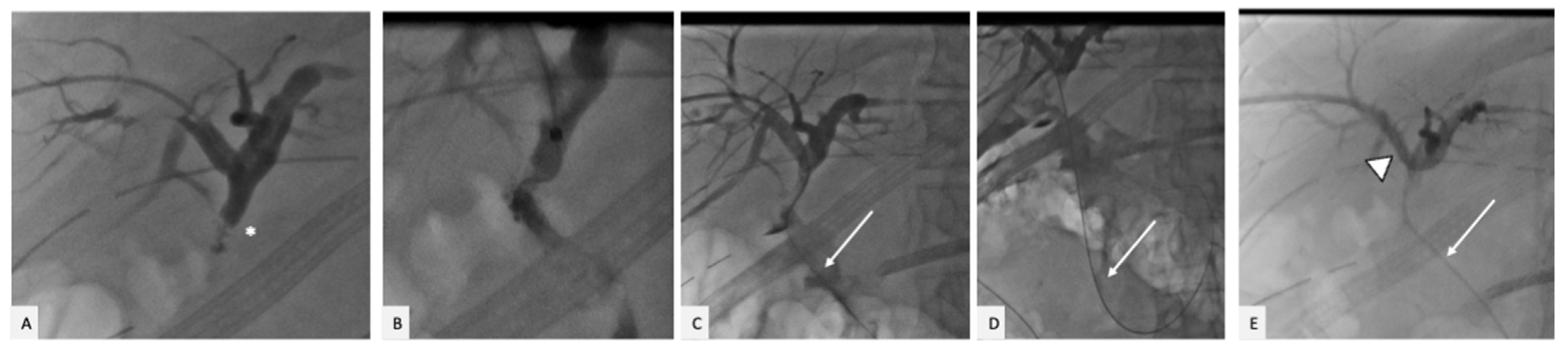 Gastrointestdisord 05 00007 g003