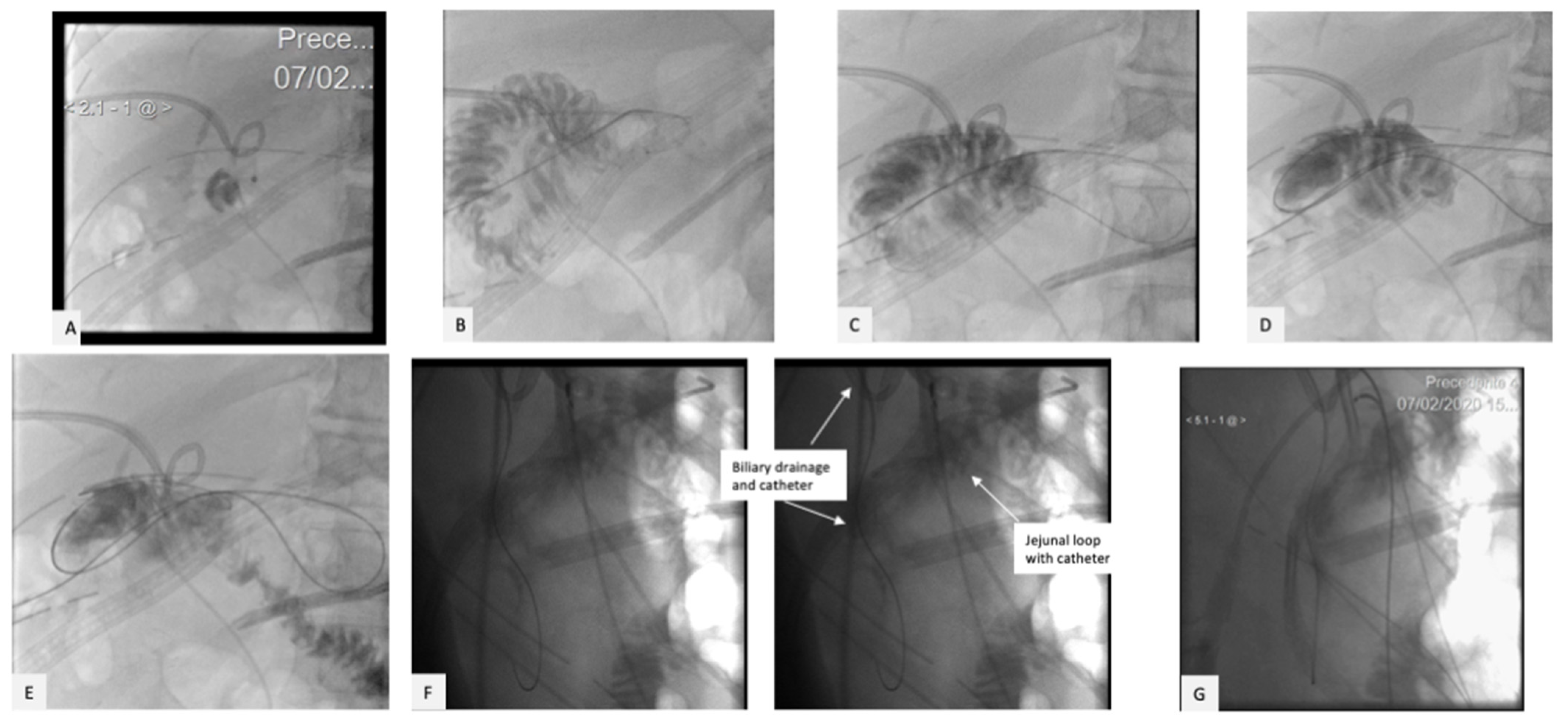 Gastrointestdisord 05 00007 g005