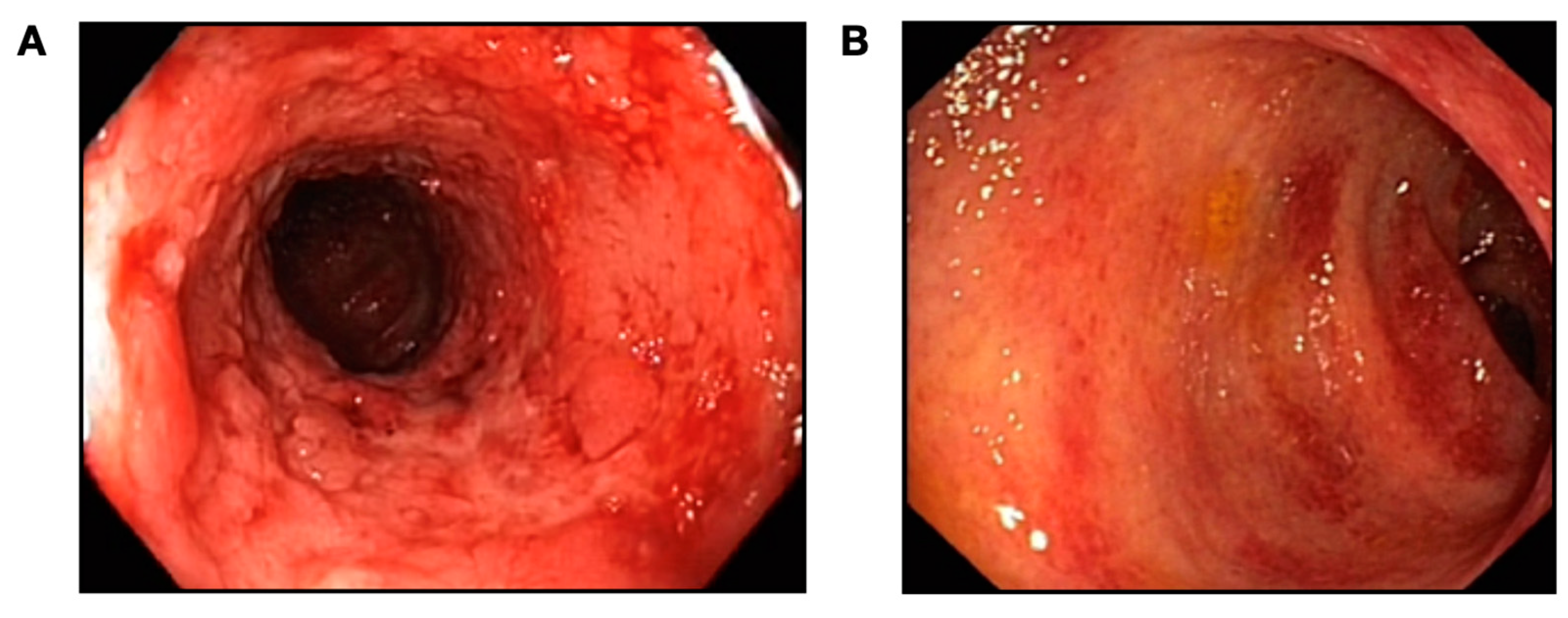 Gastrointestdisord 05 00030 g001