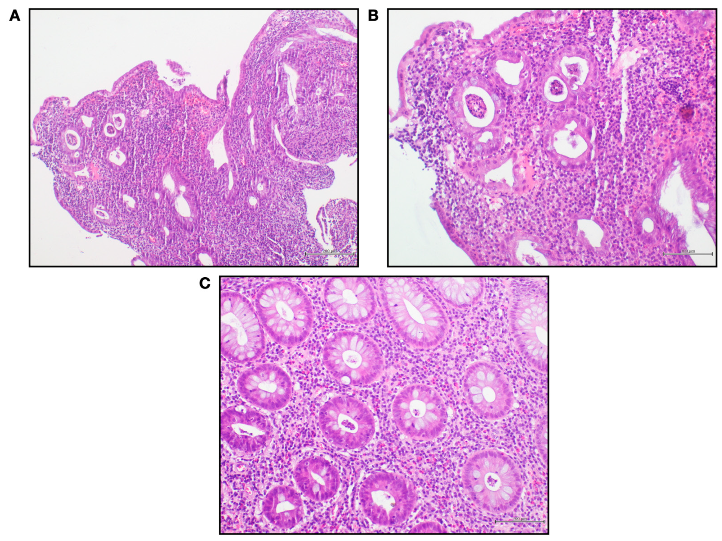 Gastrointestdisord 05 00030 g003