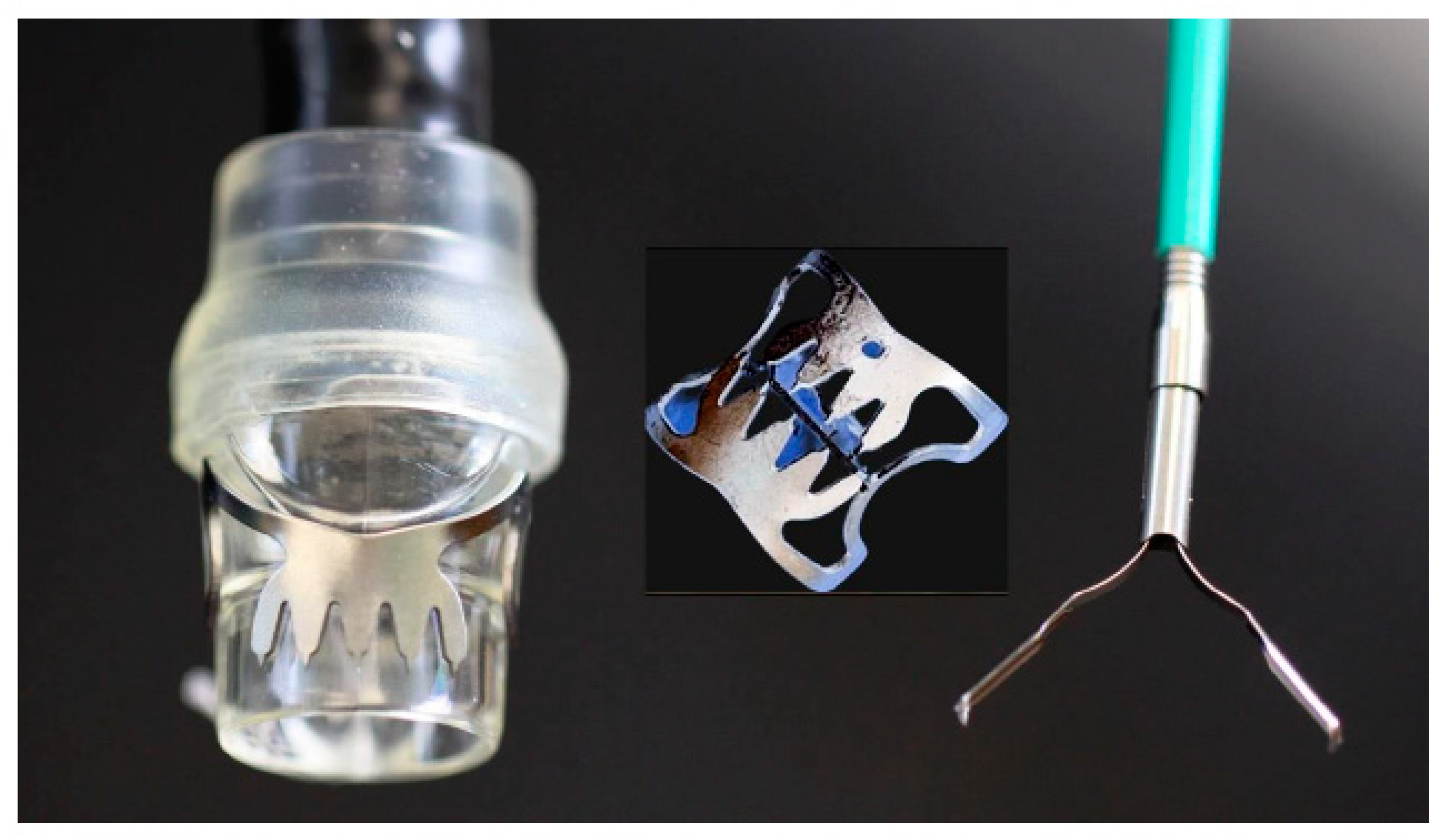 Gastrointestdisord 05 00032 g002 Gastrointestdisord 05 00032 g002